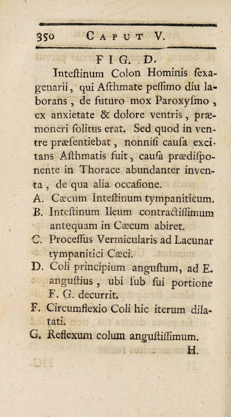 -■■ - aa —- ■ ----- 'i i ■ ... F I G. D. Inteftinum Colon Hominis fexa- genarii, qui Afthmate peflimo diu la¬ borans , de futuro mox Paroxyfmo , ex anxietate & dolore ventris, prae¬ moneri folitus erat. Sed quod in ven¬ tre praefentiebat, nonnifi caufa exci¬ tans Afthmatis fuit, caula prsedilpo- nente in Thorace abundanter inven¬ ta , de qua alia occatione. A. Caecum Inteftinum tympaniticum. B. Inteftinum Ileum contracliffimum antequam in Caecum abiret. C. Procelfus Vermicularis ad Lacunar tympanitici Caeci. D. Coli principium anguftum, ad E. anguftius , ubi lub fui portione F. G. decurrit, F. Circumflexio Coli hic iterum dila¬ tati. G, Reflexum colum anguftiffimum. ■ . H . t