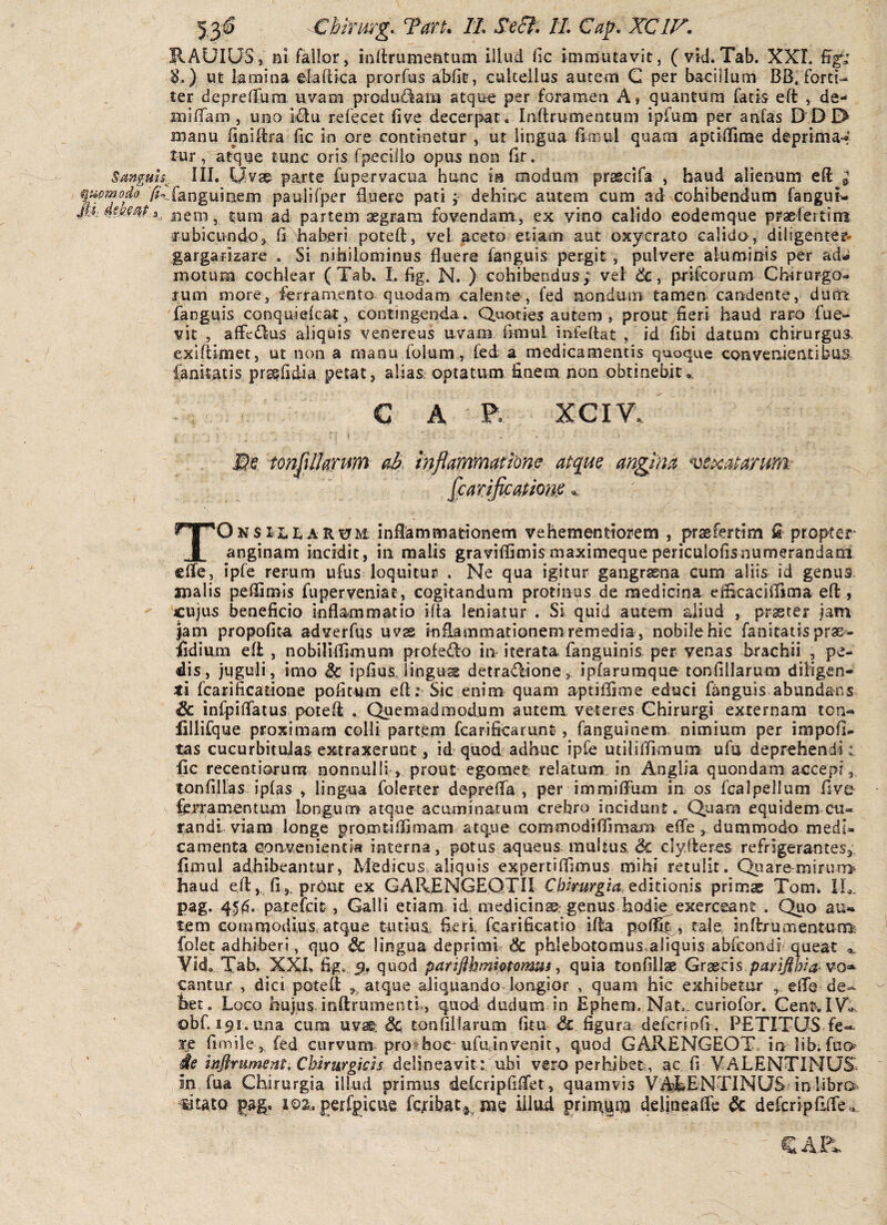 Chhmg. Tan. 11 Sea. IL Cap. XCIF. IIAUIUS, ni fallor, inlfriimeatum illud fic immutavit, (vid.Tab. XXL ut lamina elaftka prorfus abfit, cultellus autem C per bacillum BB, forti¬ ter depreffum uvam produilani atqu^ per foramea A, quantum fatis eft , de¬ mi (Tam , una i£lu refecet five decerpat, Inftrumentum ipfum per anfas D'DI> manu Bniftra fic in ore continetur , ut lingua Bmul quam aptiiUme deprima=4 tur, atque tunc oris fpecillo opu^ non Br. Sanguis. III. parte fupervacua hunc in modum prsecifa , haud alienum eft ^ qupmodo //“.fanguinem paulifper £uere pati j dehinc autem cum ad cohibendum fangui- ,, nem, turn ad partem aegram fovendana, ex vino caiido eodemque praefeitim fubicundo, fi \haberi poteft, vel aceto etiam aut oxycrato calida, diligenter* gargarizare . Si nihilominus fluere fanguis pergit , pulvere aluminis per ad^ motum cochlear (Tab. I. fig. N. ) cohibendus; vel prifcorum Chirurgo» rum more, ferramento quodam calente, fed nondum tamen candente, dum fanguis conquiefcat, contingenda. Quoties autem , prout fieri haud raro fue- vit , affedljus aliquis venereus uvam fimul infeflat , id fibi datum chirurgus exlftimet, ut non a manu folum, fed a medicamentis quoque convenientibus fanitatis prs^fidia petat, alias, optatum finem non obtinebit ^ CAR XCIV. ^ tonjilkrum oB, Infldnmmwm apqm angma vexaj^anm [car.ijicatiom TOnsIsLI,aR0M: Inflammationem vehementiorem , praefertim fl propter* anginam incidit, in malis graviflimis maximeque periculofisnumerandani f ClTe, ipfe rerum ufus loquitur . Ne qua igitur gangraena cum aliis id genus malis peifimis fuperveniat, cogitandum protinus de medicina efEcaciflima eft, 'cujus beneficio inflammatio ifla leniatur . Si quid autem aliud , prsster jam jam propofita adverfqs uvas inflammationem remedia, nobile hic fanitatis prae- iidiuni eft , nobiliflimuni profe^fto in iterata fanguinis per venas brachii , pe¬ dis, juguli, imo & ipfius iingusg detra^ione> iplarumque tonfillarum diligen¬ ti fcarificatione pofitum eft i Sic enim quam aptiflime educi fanguis abundans & infpiflatus poteft . Quemadmodum autem veteres Chirurgi externam ton- lillifque proximam colli partem fcarificarunt, fanguinersi. nimium per impofi^ tas cucurbitulas extraxerunt, id quod adhuc ipfe utiliftimum ufa deprehendi i fic recentiorun? nonnulli , prout egomet relatum in Anglia quondam accepi, tonfillas iplas , lingua folerter deprefla , per immiflum in os fcalpellum five ftrramcntufli longum atque acuminatum crebro incidunt. Quam equidem cu¬ randi viam longe pro.mtilfimam atque commodiflimam efle , dummodo medi¬ camenta convenientia interna, potus aqueus multus & clyfteres refrigerantesj fimul adhiheantur, Medicus, aliquis expertiffimus mihi retulit. Quare mirum haud e.ft, fi,, prout ex GARfiNGEQTIl editionis primas Tom» 11,. pag. 45{$. pate ici t, Galli etiam id. medicini: genus hodie exerceant . Quo au* tem comrnodius, atque tutius fieri, fcarificatio ifta polfit » tale inftrUiTientum folet adhiberi, quo & lingua deprimi & phlebotomus.aliquis abfcondi queat Vid, Tab. XXL fig., .9? quod pariflhmhtomm ^ quia tonfillas Gr^cis pptrlfima vo^ cantur , dici poteft atque aliquando longior , quam hic exhibetur , efls de¬ bet. Logo hujus, inftrumenti,, quod dudum in Ephera, Nat., curiofor. CenKlVi^ obf. 191. una cum uvae; tonfillarum fitu & figura defcripfi, PETITLIS fe¬ re rimile,,fed curvum pro@hoc ufujnvenit, quod GAILENGEOT in libifuo ie infirtiment. Chirurgicis delineavit: ubi vero perhibet, ac fi VALENTINUS in fua Chirurgia illud primus delcripfiflet, quamvis VAiLENTINUS inlibrO' ^siuto pag. i02.perfpicvie fcribat«., Pas iilad. primam delineafle & defcriplKTe^.