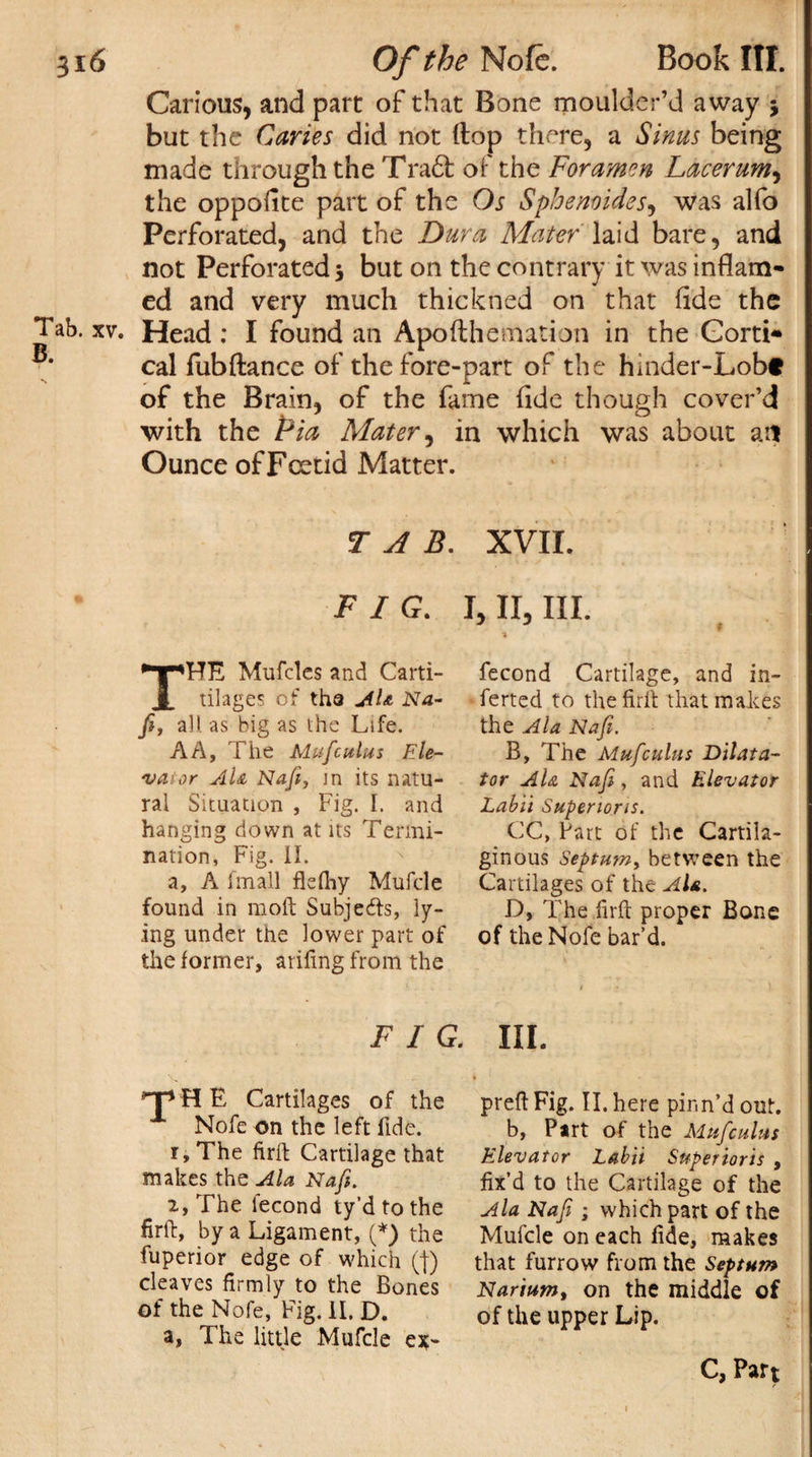 Carious, and part of that Bone moulder’d away j but the Caries did not (top there, a Sinus being made through the Tra6t of the Foramen Lacerum, the oppofite part of the Os Sphenoides, was alfo Perforated, and the Dura Mater laid bare, and not Perforated 5 but on the contrary it was inflam¬ ed and very much thickned on that fide the Tab. xv. Head: I found an Apofthemation in the Gorti* cal fubftance of the fore-part of the hinder-Lobf of the Brain, of the fame fide though cover’d with the Pia Mater, in which was about aft Ounce of Foetid Matter. TAB. XVII. FIG. I, II, III. THE Mufcles and Carti- tilages of tha AU Na- fi, all as big as the Life. AA, The Mufculus Ele¬ vator AU Nafi, in its natu¬ ral Situation , Fig. 1. and hanging down at its Termi¬ nation, Fig. II. a, A imall flefhy Mufcle found in moil Subjects, ly¬ ing under the lower part of the former, arifing from the fecond Cartilage, and in¬ serted to the firft that makes the Ala Nafi. B, The Mufculus Dilata¬ tor AU Nafi, and Elevator Labii Superiors. CC, Part of the Cartila¬ ginous Septum, between the Cartilages of the AU. D, The firft proper Bone of theNofe bar’d. FIG. HI. THE Cartilages of the Nofe on the left fide. r,The firft Cartilage that makes the Ala Nafi. 2, The fecond ty’dtothe firft, by a Ligament, (*) the fuperior edge of which (j) cleaves firmly to the Bones of the Nofe, Fig. II. D. a, The little Mufcle ex- preft Fig. II. here pinn’d out. b, Part of the Mufculus Elevator Labii Superioris , fix’d to the Cartilage of the Ala Nafi ; which part of the Mufcle on each fide, makes that furrow from the Septum Narium, on the middle of of the upper Lip. c, Part