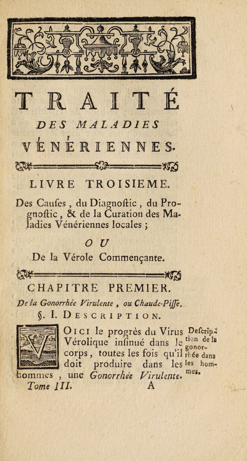 DES MALADIES VENERIENNES. S^r==r=========@ —===^ LIVRE TROISIEME. Des Caufes , du Diagnoftic , du Pro- gnoftic , ôc de la Curation des Ma¬ ladies Vénériennes locales ; O U De la Vérole Commençante. CHAPITRE PREMIER. Vi lii Gonorrhée Virulente , ou Chaude-PiJJe, §. 1. Description. O ICI le progrès du Virus pefcrîpi Vérolique infinué dans ^ 1 r • gonor- corps , toutes les fois qu il rhée dans doit produire dans les hom- hommes , une Gonorrhée Virulente* Tome IIL A