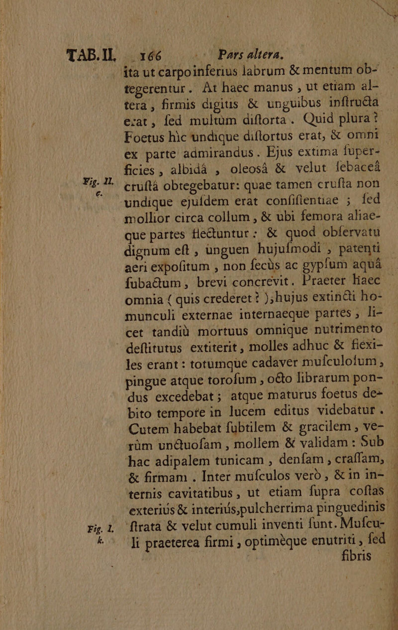 NEL TAB.1l. 2 Fig. 1L €. E:g. 1. k. . 166 ^ Pars altera. tegerentur. At haec manus , ut etiam al- e:at , fed multüm diflorta. Quid plura? Foetus hic undique diflortus erat; &amp; omni ficies , albidá , oleosá &amp; velut lebaceá cruítà obtegebatur: quae tamen crufta non undique ejuídem erat confifientiae ; fed que partes fle&amp;untur: &amp; quod obíervatu dignum eft , unguen hujufmodi , patenti aeri expofitum , non fecüs ac gyplum aquá fuba&amp;tum , brevi concrevit. Praeter liaec omnia ( quis crederet ? );hujus extin&amp;i ho- munculi externae internaeque partes , li- cet tandiü mortuus omnique nutrimento deflitutus extiterit, molles adhuc &amp; fiexi- les erant : totumque cadaver mulfculofum , pingue atque torofum , o&amp;o librarum pon- dus excedebat; atque maturus foetus de- Cutem habebat fübtilem &amp; gracilem , ve- rüm uncuofam , mollem &amp; validam : Sub &amp; firmam . Inter muículos vero , &amp; in in- ftratà &amp; velut cumuli inventi funt. Mufcu- li praeterea firmi ; optiméque enutriti , fed CURA SW |. fibris D