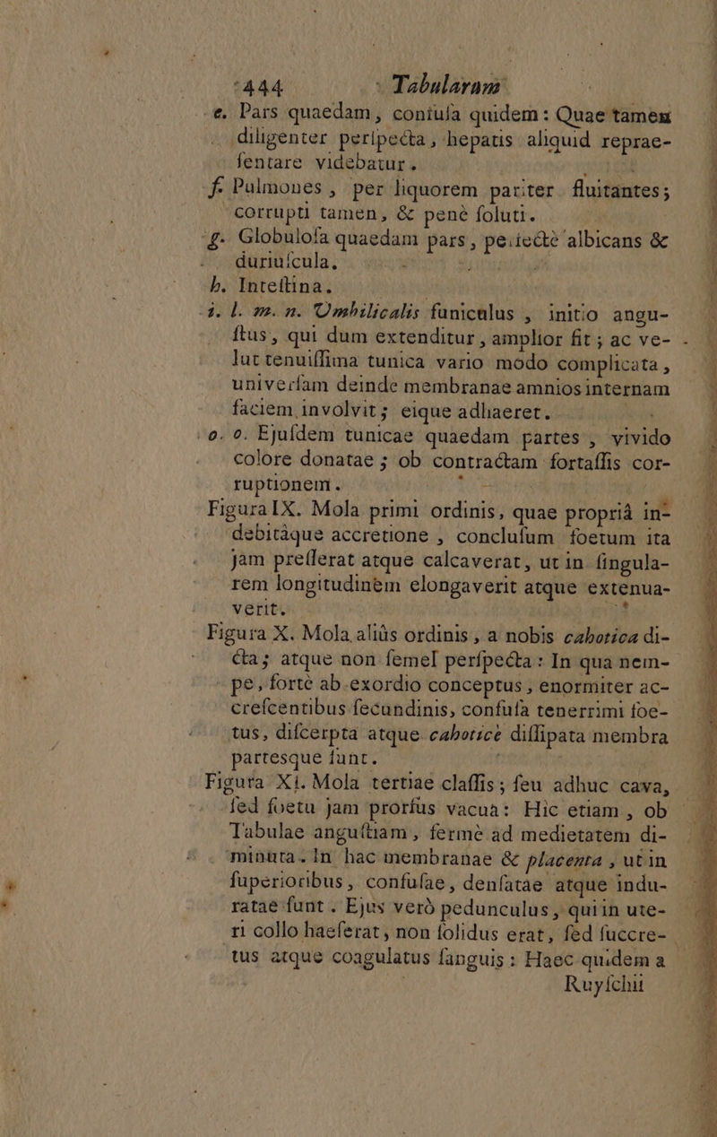 /*444 - Tabularanr €. Pars quaedam, coniuía quidem : Quae tamex . diligenter peripecta, hepatis aliquid reprae- — fentare videbatur. 250 5d ) f Pulmones , per liquorem pariter. fluitantes; | corrupti tamen, &amp; pené foluti. | | 4 Globulofa quaedam pars, peiiecté albicans &amp; — | düritiicula. i sues wn sym ua j b. Inteftina. | | j d.d. meom. Umbilicalis funicnlus , initio angu- | ftus, qui dum extenditur, amplior fit; ac ve- lut tenui(fima tunica vario modo complicata , univerfam deinde membranae amniosinternam faciem involvit ; eique adhaeret. . . e. 9. Ejufídem tunicae quaedam partes , vivido colore donatae ; ob contractam fortaífis cor- ruptionem. To Eden ns Figura IX. Mola primi ordinis, quae proprià in- debitàque accretione , conclufum foetum ita jam pre(lerat atque calcaverat, ut in fingula- rem longitudinem elongaverit atque extenua- verit. | uai ana Figura X. Mola. aliüs ordinis, a nobis cabotica di- ca; atque non femel perfpecta : In qua nem- - pe. forté ab.exordio conceptus , enormiter ac- crefcentibus fecundinis, confula tenerrimi foe- tus, difcerpta atque. caborzce diflipata membra partesque funt. ! , Figura X1. Mola tertiae claffis ; feu adhuc cava, E. . ed foetu Jam prorfus vacua: Hic etiam , ob — Tabulae angu(tiam , fermé ad medietatem di- minuta.In hac membranae &amp; p/acenra , utin fuperioribus, confufae, denfatae atque indu- ratae funt . Ejus veró pedunculus , quiin ute- r1 collo haeferat , non lolidus erat, fed fuccre- tus atque coagulatus fanguis : Haec quidem a | Ruyíchit