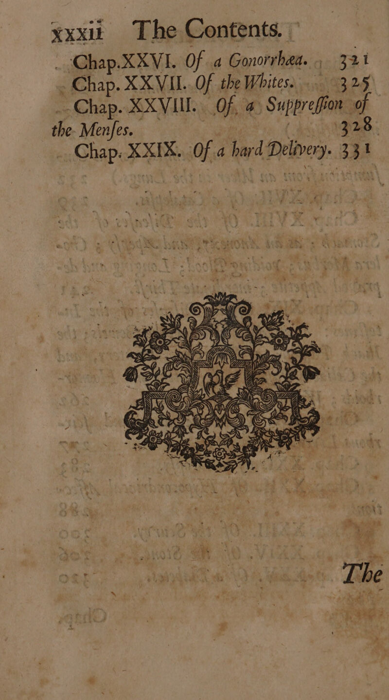 . Chap.XXVI. Of a Gonorrhea... 321 ; Chap. XX VII... Of the Whites... 325 - Chap. XXVIII. . of. a Sup on oa the. Men/es. 328 Chap. FER Of a hard Debes à a | rr »* Ln M ee * L n i 3 NS VR P : SN vem ie A AX j z ee KS ZA Af : y NG e » 5 po bol 4 , ^ = b =) L] a^ s [ - g B T d * ts » 50. 5 3 e ee ET eM E | The ( ^a ; ^ E hc. P poke Lau 5