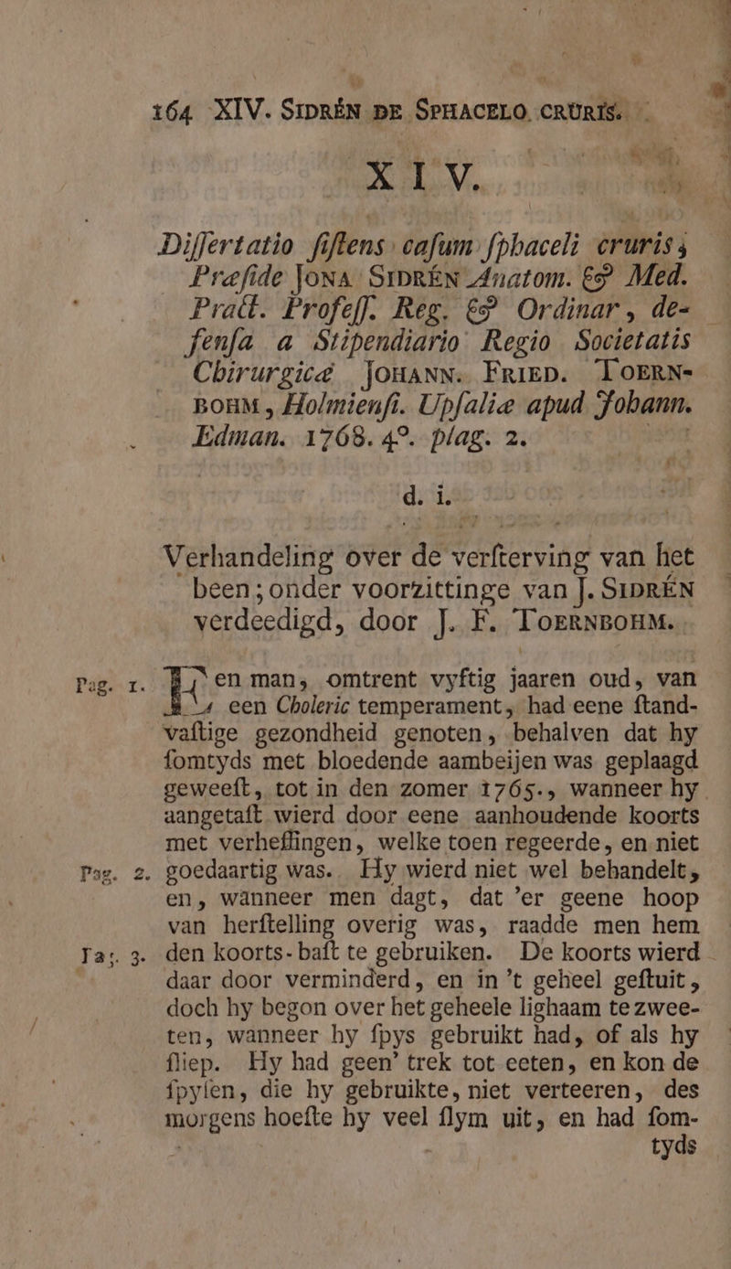 ár 164 XIV. SipRÈN pr SPHACELO CRURIS. — ij od on Mn Diflertatio fi iftens cafum (phacel eruris; _Prefide Jona’ SrprÉN Anatom. €” Med. Praft. Profeff. Reg. €” Ordinar , de- Chirurgic&amp; JOHANN. Friep. LOERN- BOHM ‚-Holmienfi. Upfalie apud en Edman. 1768. 4°. plag. 2. d, L. Verhandeling over de Vd van het been ;onder voorzittinge van]. SIDRÉN verdeedigd, door J.F, ToERNBOHM.. Pag. 1. Len man; omtrent vyftig pn oud, van „4 een Choleric temperament, had eene ftand- vaftige gezondheid genoten, behalven dat hy fomtyds met bloedende aambeijen was geplaagd aangetaft wierd door eene aanhoudende koorts met VERAGDOESn , welke toen regeerde, en-niet Pag. 2. goedaartig was. Hy wierd niet wel behandelt, en, wänneer men dagt, dat ’er geene hoop van herftelling overig was, raadde men hem daar door verminderd, en in ’t geheel geftuit , doch hy begon over het geheele lighaam te zwee- ten, wanneer hy fpys gebruikt had, of als hy fliep. Hy had geen’ trek tot eeten, en kon de ípylen, die hy gebruikte, niet verteeren, des morgens hoefte hy veel she uit, en had ee tyds