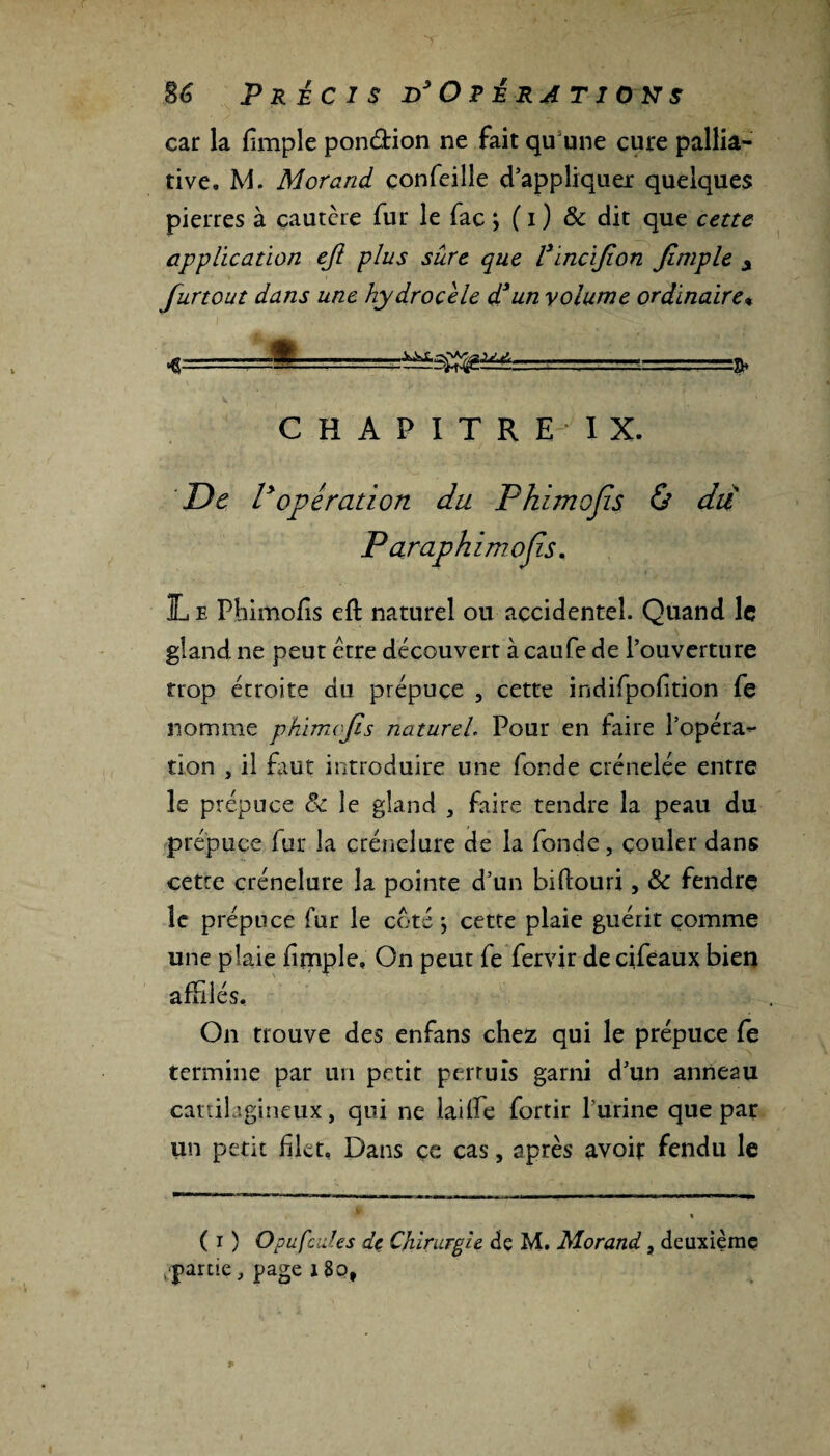 car la fimple pon&ion ne fait qu'une cure pallia¬ tive. M. Morand çonfeille d’appliquer quelques pierres à cautère fur le fac ; ( i ) & dit que cette application eji plus sure que l3incijion Jimple y furtout dans une hydrocèle d3un yolume ordinaire% « ..SL,..... C H A P I T R E I X. De lyopération dit Phimojis & du P araphimojis. IL e Fhimofîs eft naturel ou accidentel. Quand le gland ne peut être découvert à caufe de l’ouverture trop étroite du prépuce , cette indifpof tion fe nomme phimofis naturel Pour en faire l’opéra¬ tion , il faut introduire une fonde crénelée entre le prépuce & le gland , faire tendre la peau du prépuce fur la crénelure de la fonde, couler dans cette crénelure la pointe d’un bidouri, 8c fendre le prépuce fur le coté ; cette plaie guérit comme une plaie fmple, On peut fe fervir decifeaux bien affilés. On trouve des enfans chez qui le prépuce fe termine par un petit permis garni d’un anneau cartilagineux, qui ne laide fortir l’urine que par un petit ûlet. Dans çe cas, après avoif fendu le ( i ) Opu fades de Chirurgie de M. Morand, deuxième ^partie , page 13o,