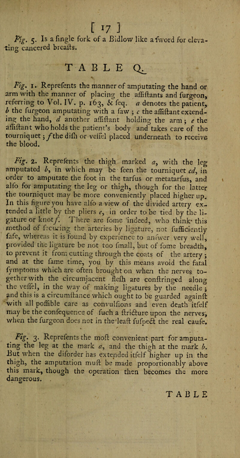 C i7 1 Pig. 5. Is a Tingle fork of a Bidlow like alword for eleva¬ ting cancered breafts. TABLE Pig. 1. Reprefents the manner of amputating the hand or arm with the manner of placing the affiftants and furgeon, referring to Vol. IV. p. 163, feq. a denotes the patient., b the furgeon amputating with a faw ; c the affiftant extend¬ ing the hand, d another affiftant holding the arm; e the affiftant who holds the patient’s body and takes care of the tourniquet 3 /thedilh or velfel placed underneath to receive the blood. Fig. 2. Reprefents the thigh marked <?, with the leg amputated b, in which may be feen the tourniquet cd, in order to amputate the foot in the tarfus or metatarfus, and alfo for amputating the leg or thigh, though for the latter the tourniquet may be more conveniently placed higher up. In this figure you have alfo a view of the divided artery ex¬ tended a little by the pliers in order to be tied by the li¬ gature or knot/. There are Tome indeed, who think* this method of Retiring the arteries by ligature, not fufficientiy fafe, whereas it is found by experience to anfwer very well, provided the ligature be not too fmall, but of fome breadth, to prevent it from cutting through the coats of the artery j and at the fame time, you by this means avoid the fatal fymptoms which are often brought on when the nerves to¬ gether with the circumjacent ftefti are conftringed along the veftel, in the v/ay or making ligatures by the needle 3 and this is a circumftance which ought to be guarded againft: with all poftible care as convulfions and even death itfelf may be the confequence of fuch a ftricfture upon the nerves, when the furgeon does not in the leaft fufpedt the real caufe. v f Fig. 3. Reprefents the moft convenient part for amputa¬ ting the leg at the mark a, and the thigh at the mark b. But when the diforder has extended itfelf higher up in the thigh, the amputation muft be made proportionably above this mark, though the operation then becomes the more dangerous. . TABLE 1