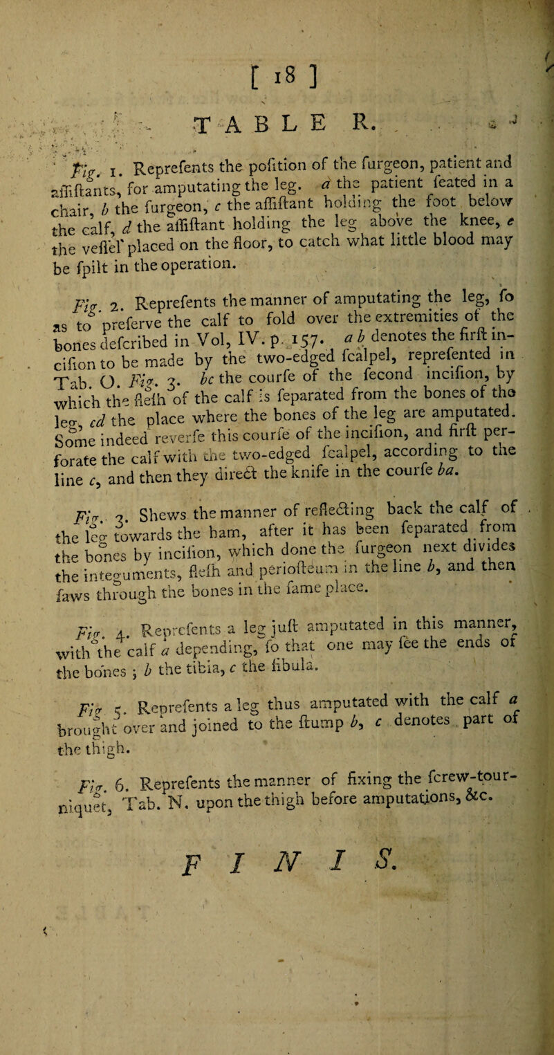 chair b the furgeon, c the affiftant holding the foot below the calf d the affiftant holding the leg above the knee, e the veflel' placed on the floor, to catch what little blood may be fpilt in the operation. v- ~ -R pnrefents the manner of amputating the leg, fo Some indeed reverfe this courfe of the incifion, and firft per¬ forate the calf with the two-edged fcalpel, according to tne line c, and then they direft the knife in the courfe ba. .1_eofloAI n rv kapV ffl P PSlf of , z?;„ A R pnrefents 3. \qh iuft amputated in this manner. the bones \ b the tibia, c die fibula. Frr e. Renrefents a leg thus amputated with the calf a brought over ‘and joined to the ftump b, c denotes part of the thigh. p;„ 6. Reprefents the manner of fixing the ferew-tour- niquet, Tab. N. upon the thigh before amputations, &c. FINIS.