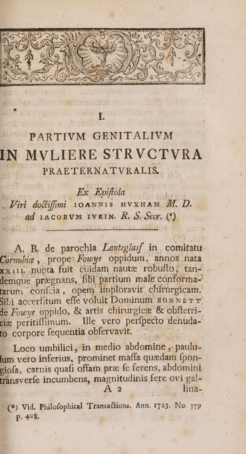 PRAETERNATVRALIS.. EC. Ex, Eyiflola E . Viri dolifmi 10ANNis nvxuHaAm AL D. ad 1acoBVM IVRIN. À. S. Secr. (7) - A. B. de parochia ZLanteglasf in. comitatu. Cornubig , prope: Fowye oppidum, annos nata xxiir nupta fuit cuidam nautze robufto,; tan- lemque pr&amp;egnans, fibi partium male conforma- tarum confcia, opem imploravit chirürgicam. Sibi accerfitum effe voluit Dominum 80 NNg TT le Fowye oppido, &amp; artis chirurgice &amp; obftetri- cim peritifhimum. — lle vero perfpecto denuda- to corpore fequentia obfervavit. ^ — -— Loco umbilici, in medio abdomine ,: paulu- lum vero inferius, prominet maffa quedam fpon- Giofa, carnis quafi offam pre fe ferens, abdomini transveríe incumbens, magnitudinis fere ovi gal- A 2 lina- t (9 Vid. Philofophical Transactions, Ann. 1723. No. 379 p. 498. ; m.
