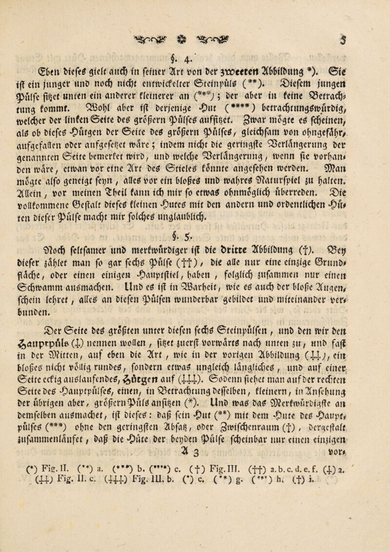 §. 4-' <26eti tiefes gieft auch in feiner Urt von ber 3t»ettett 2C66i(t>un^ *). ©ie tff ein junger unb noch nicht entwicfelter ©teinpülS (**). ©tefem jungen jpfilfe ßijef unten ein anberet fletnerer an (***; ; ber aber in feine Vetracfj? tung fommf. SJBopt aber iß derjenige -put (****) betrachfungSw/trbig, ttjetctjer ber linfen©ette beS großem ipülfeS aufßfjet. gwar mogte es fcheinen, als ob tiefes -putgen ber ©eite beS großem fpitlfeS, gleichfam von oßngefäßo aufgefallen ober aufgefehct wäre; intern nicht tie geringße Verlängerung bet genannten ©eite bemerfet wirb, unb welche Verlängerung, trenn fte torßan» tenmare, etwan vor eine Zrt tes ©tieles fonnte angcfeben werben. 9J?an mogte alfo geneigt fepn, alles ror ein bloßes nnb wahres STaturfpiel ju halten. Allein, vor meinen ^beil fann icf) mir fo etwas obntuogltcf) uberreben. ©ie »oflfommene ©eßalt tiefes fleinen -putes mit ben anbern unb orbentlidjen Jpfo ten tiefer ipßlfe macht mir folcheS unglaublich. §• 5- Vocfj feltfamer unb merfwurbiger iß bie örttce 2(bbtfbung (f), Vei; tiefer jaßlef man fo gar fechs pfiffe (f f), tie alle nur eine einjtge ©runb* fläche, ober einen einigen -pauptßiel, haben , folglich jufammen nur einen ©chwanim ausmachen. Unb es iß in QBarheif, wie es auch ber bloße 2fugen* fcheiit lehret, alles an tiefen Wulfen wunberbar gebilbet unb mitetnanber »er< bunten. ©er ©eite beS größten unter biefen fechs ©teinpulfen , unb ten wir ben ^anptpfll» (i) nennen wollen , fifjet juerß vorwärts nach unten ju, unb faß in ber SWitten, auf eben bie 2Crt, wie in ber »origen 21bbtlbung (44;, ein bloßes nicht »eilig runbes, fonbern etwas ungleich längliches, unb auf einer ©eite ccftg auSlaufenbeS, &inge tt auf (4.44). ©obenn flehet mau auf ber rechten ©eitebcS -pauptpulfeS, einen, in SSetrachtungbeßelben, fleinern, in2tnfehung ber übrigen aber, großem'puls anft^en (*). Unb was bas SÄerfwßrbigße an bemfelben ausmachet, iß tiefes: baß fein -put (**) mit tem glitte beS -paupt, pfiifes (***) ohne ben geringßen 2lbfalj, ober ^wifchcnraum (f), bergeßait äufammenlaufet, baß bie-Pute ber bepben ipiilfe fcheinbar nur einen einjtgen 2t 3 vor» OFi2.lI. (’*)»• ('••) b. (’*) c. (f) Fig.lII. (ff) a. b. c. <i. e. f. (40 a. '