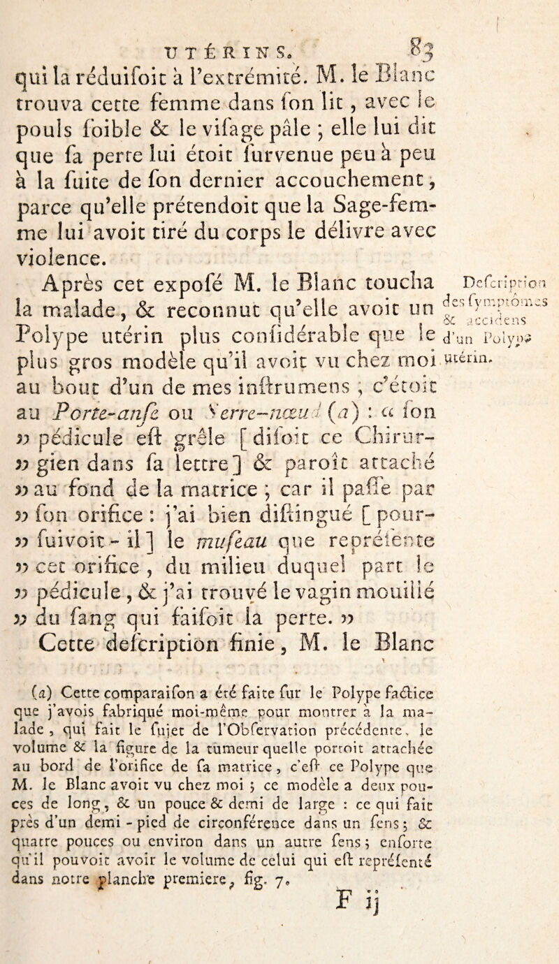 .J ion des fympr ornes 6c a ce i de ns n Polype UTÉRINS. qui la réduifoit à l’extrémité. M. le Blanc trouva cette femme dans ton lit, avec le pouls foible & le vilage pâle \ elle lui dit que fa perte lui étoit lurvenue peu à peu à la fuite de fon dernier accouchement, parce qu’elle prétendoit que la Sage-fem¬ me lui avoit tiré du corps le délivre avec violence. Après cet expolé M. le Blanc toucha Defcnpt la malade, & reconnut qu’elle avoit un Polype utérin plus conlidérable que le plus gros modèle qu’il avoit vu chez moi «téun au bout d’un de mes inftrumens , c’étoit au Porte-anje. ou S erre-nœud (a) : a ion 33 pédicule eft grêle [ diiott ce Chirur- 33 gien dans fa lettre] & paroît attaché 33 au fond de la matrice ; car il pafîe par 33 ion orifice : j’ai bien diftingué [ pour- 33 fuivoit - il ] le mufe.au que repréfente 33 cet orifice , du milieu duquel part le 33 pédicule, & j’ai trouvé le vagin mouillé >3 du fang qui faifoit la perce. 33 Cette defeription finie, M. le Blanc (a) Cette comparaifon a été faite fur le Polype faélice que j’avois fabriqué moi-même pour montrer à la ma¬ lade , qui fait le fiijet de l’Obfervation précédente., le volume St la figure de la tumeur quelle porroit attachée au bord de l’orifice de fa matrice, c eft ce Polype que M. le Blanc avoir vu chez moi ; ce modèle a deux pou¬ ces de long, St un pouce & demi de large : ce qui faic près d’un demi - pied de circonférence dans un fens ; & quatre pouces ou environ dans un autre fens ; enforte quil pouvoir avoir le volume de celui qui eft reprélenté dans notre plancha première, fig. 7* F. « 1]
