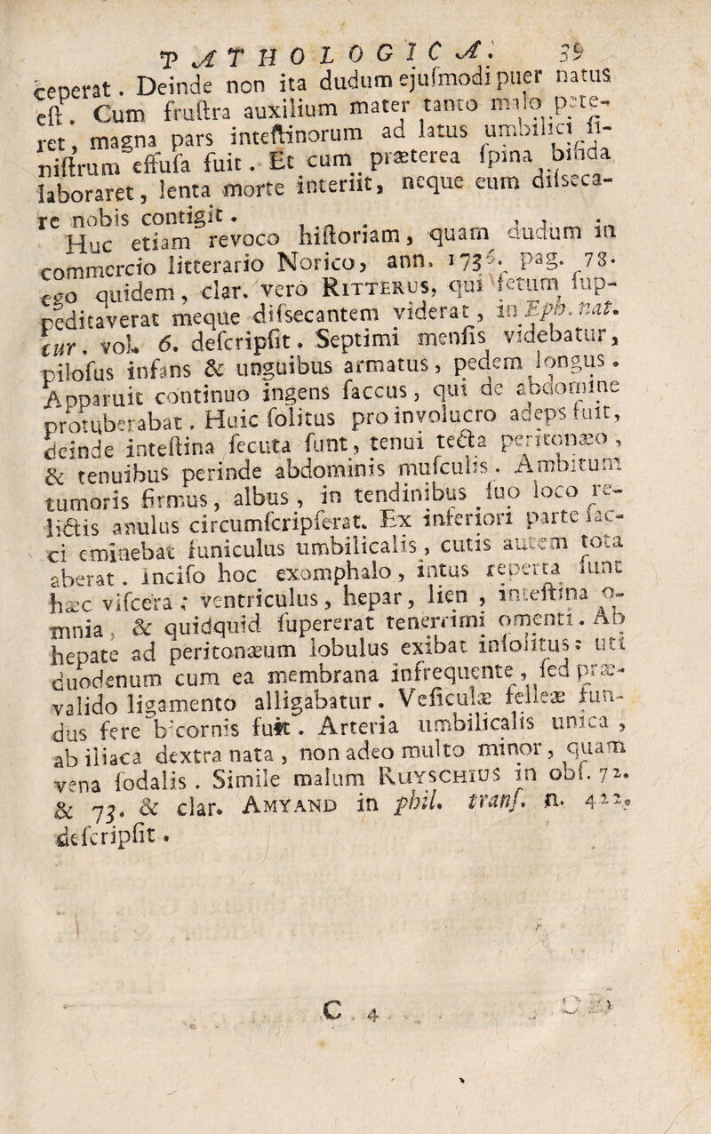 ceoerat . Deinde non ita dudum ejufmodi puer natus eft . Cum fruftra auxilium mater tanto malo pete¬ ret magna pars inteftinorum au latus umoihci - niftrum effufa fuit. fit cum_ prteterea fpma bmda laboraret, lenta morte interiit, neque eum dils^ca- reHuc'SetiamSrevoco hiftoriam, quam dudum in commercio litterario Norico? ann, 17?f• P3S- 78* L0 quidem, clar. vero Ritterus, qui fetum fup- reditaverat meque difsecantem viderat, mEpb.nat. cur. voL 6. defcripfit» Septimi rnenfis videbatur, pilofus infans 6c unguibus armatus, pedem longus. Anna ruit continuo ingens faccus, qui ae abdomine protuberabat. Huic folitus pro involucro adeps fuit, deinde inteftina fecuta funt, tenui teda peritonaeo , & tenuibus perinde abdominis mufcuhs. Ambitum tumoris firmus, albus, in tendinibus fup loco k- lidtis anulus drcumfcripferat. Ex inferiori parte i ac¬ ci eminebat funiculus umbilicalis , cutis autem tota aberat, incifo hoc exomphalo, intus reperta iunt hxc vi (cera ; ventriculus, hepar, lien , inteftina o- mnia & quidquid fupererat tenerrimi omenti . Ab hepate ad peritonaeum lobulus exibat inion tus: uti duodenum cum ea membrana infrequente, fed prae¬ valido ligamento alligabatur. Veficulae felieae fun¬ dus fere bxornis fuft. Arteria umbilicalis unica , ab iliaca dextra nata , non adeo multo minor, quam vena fodalis . Simile malum Ruyschius in obi. 7^ & 7^, & clar* Amyand in fhiU tranj, fi- a-11? defcripfit* C . 4 *