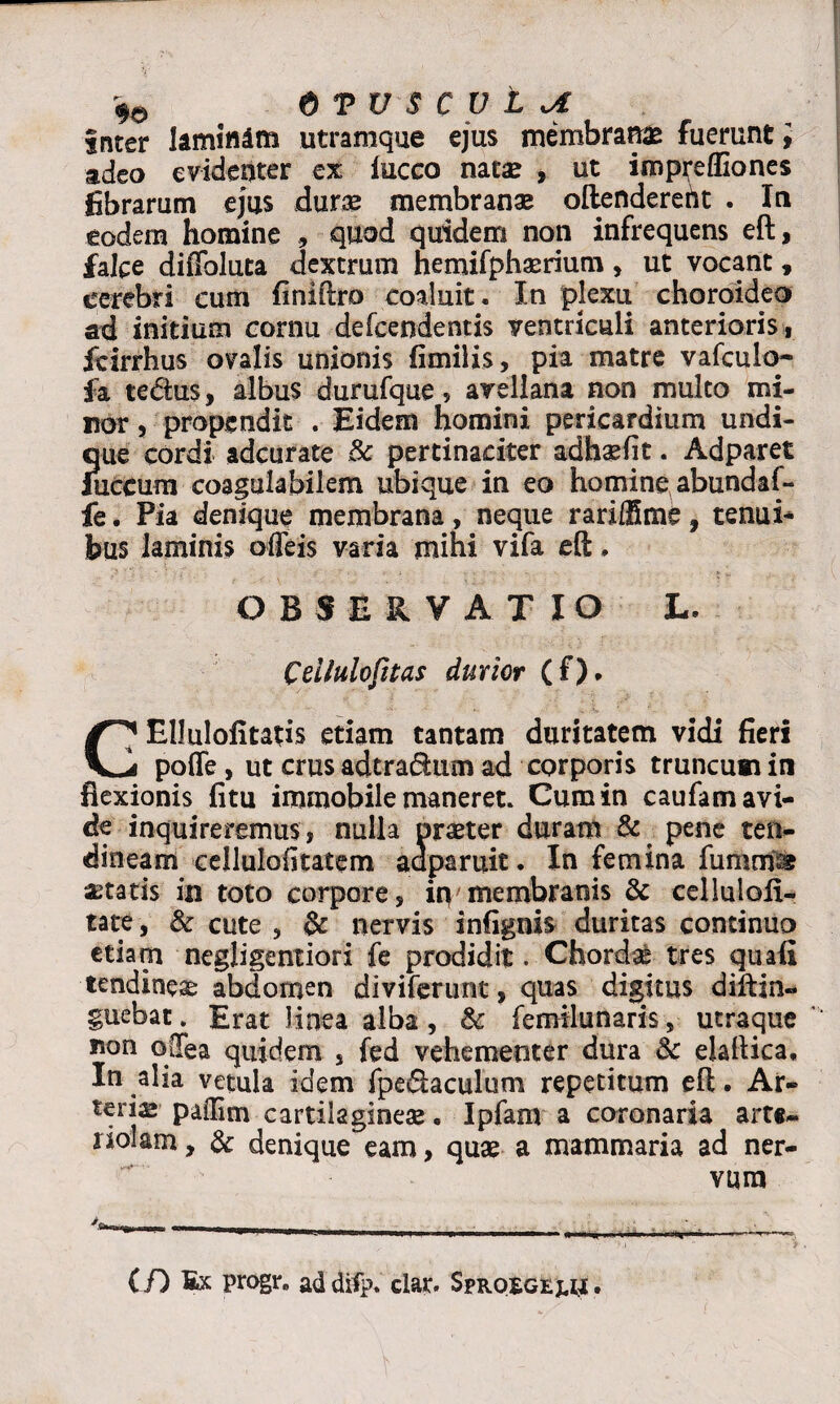fiTUSCULiA inter lamindm utramque ejus membrana fuerunt; adeo evidenter ex lucco natae , ut imptefliones fibrarum ejus dura membrana oftendereht . In eodem homine , quod quidem non infrequens eft, falce diiToluta dextrum hemifphaerium, ut vocant, cerebri cum finiftro coaluit. In plexu choroideo ad initium cornu defcendentis ventriculi anterioris , fcirrhus ovalis unionis fimilis, pia matre vafculo- fa tedus, albus durufque , avellana non multo mi¬ nor , propendit . Eidem homini pericardium undi¬ que cordi adcurate & pertinaciter adhafit. Adparet iliceum coaguiabilem ubique in eo homine, abundaf- fe. Pia denique membrana, neque rariffime, tenui¬ bus laminis offeis varia mihi vifa eft. OBSERVAT IO L. Cei Iulo fit as durior (£). Ellulofitatis etiam tantam duritatem vidi fieri VJ pofle, ut crus adtra&um ad corporis truncum in flexionis fitu immobile maneret. Cum in caufam avi¬ de inquireremus , nulla orater duram & pene ten¬ dineam cellulofitatem adparuit. In femina fument aetatis in toto corpore, in membranis & celluloli- tate , & cute , & nervis infignis duritas continuo etiarn negligenxiori fe prodidit. Chorda tres quafi tendinea abdomen diviferunt, quas digitus diftin- guebat. Erat linea alba , & fermlunaris, utraque non oOTea quidem 5 fed vehementer dura & elaftica. In alia vetula idem fpe&aculum repetitum eft. Ar¬ teriae pafiim cartilagineae. Ipfam a coronaria arte- nolam, & denique eam, quae a mammaria ad ner¬ vum