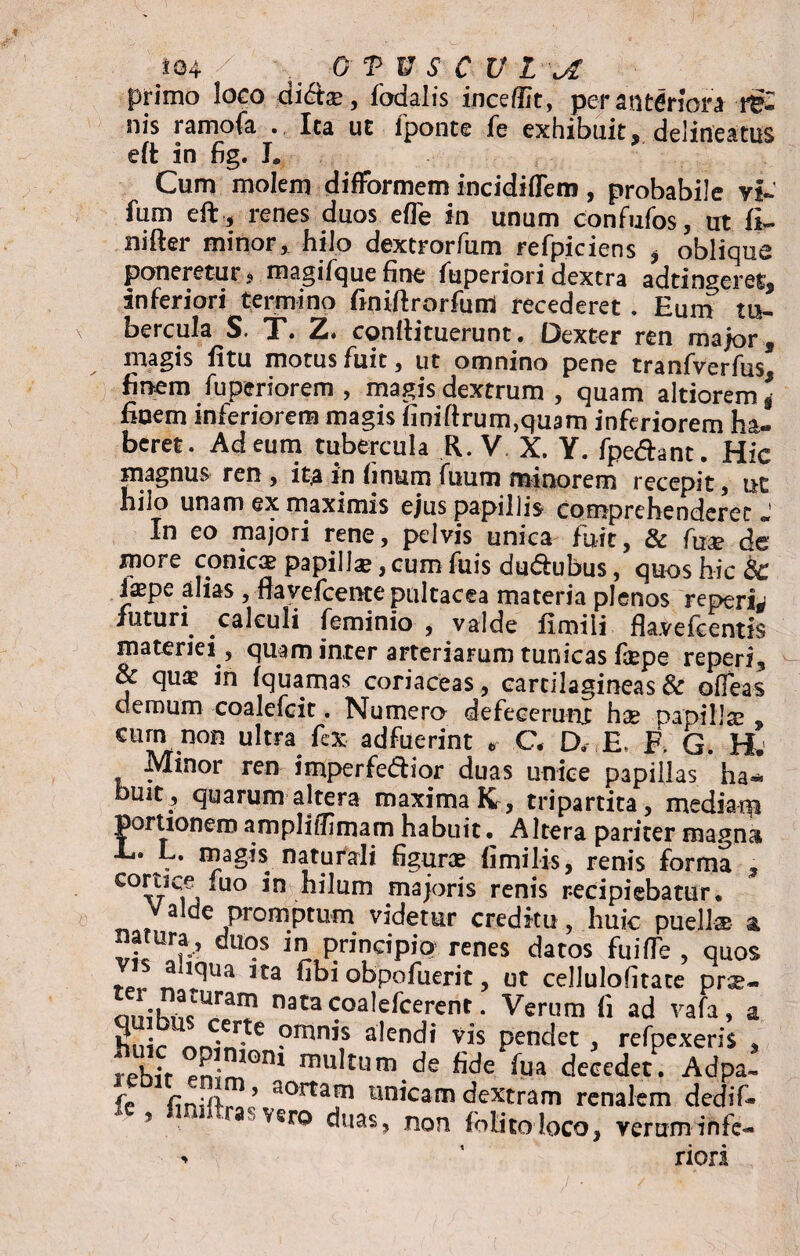primo loco didtse, fodalis inceffit, peranteriora re¬ nis ramofa Ita ut iponte fe exhibuit, delineatus eft in fig. I# Cum molem difformem incidiffem, probabile vi- fum eft , renes duos efle in unum confufos, ut fi- nifter minor, hilo dextrorfum refpiciens , oblique poneretur $ magifque fine fuperiori dextra adtingeret, inferiori termino finiftrorfum recederet . Eum tu¬ bercula ST. Z. conttituerunt. Dexter ren major, magis fitu motus fuit, ut omnino pene tranfverfus finem fupcriorem , magis dextrum , quam altiorem \ fiuem inferiorem magis finiftrum,qu3m inferiorem ha¬ beret. Ad eum tubercula R. V X. Y. fpedhnt. Hic magnus ren , ita in imum fuum minorem recepit, ut hilo unam ex maximis ejus papillis comprehenderet «J In eo majori rene, pelvis unica fuit, & fu* de inore conicae papillae, cum fuis dudiubus, quos hic & iaepe alias , navefcentepultacea materia plenos reperis futuri. calculi feminio , valde ftmili fla.vefcentis materiei, quam inter arteriarum tunicas f®pe reperi, & qu® in fquamas coriaceas, cartilagineas & ofleas demum coalefcit. Numero defecerunt hx papilla , cum non ultra fex adfuerint * C, D. E, F G. H. Minor ren imperfe<ftior duas unice papillas ha* uit , quarum altera maxima K , tripartita, mediani portionem amplitTImam habuit • Altera pariter magna T» L. magis naturali figur® fimilis, renis forma , C°vCij uo 3n .^ilum majoris renis recipiebatur. alde promptum videtur creditu, huic pueli® a natura, duos in principio renes datos fu i (Te , quos ^1(lUa 3ta fibi obpofuerit, ut cellulofitate pr®« onibi^T naCa<^oa^fcerent. Verum ii ad vafa, a Snir onin te ?mnis a^endi vis pendet , refpexeris , rebir emm*00? rnu^turn.de fide fua decedet. Adpa~ fe finilfrnj aortajn unicam dextram renalem dedif- ? . aspero duas, non folitoloco, verum in fe- » ’ riori
