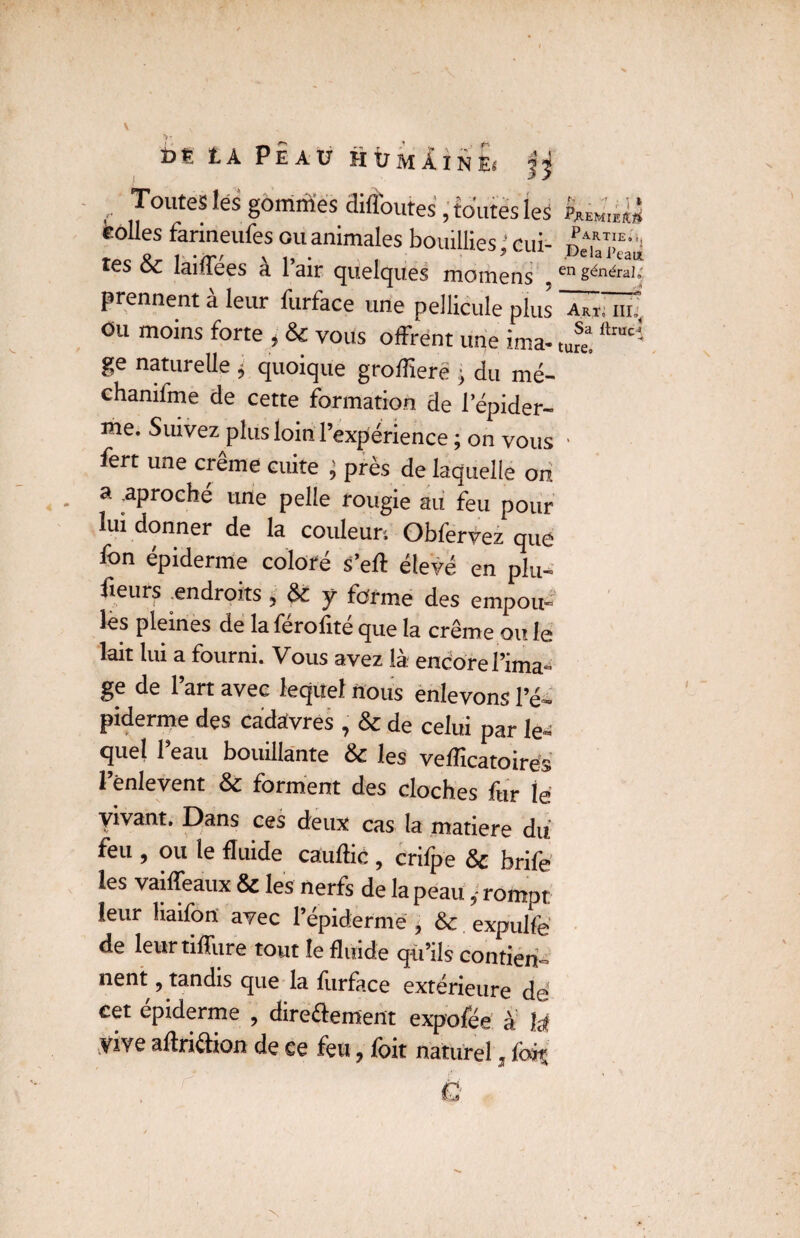t>p, f.a Peau H ù m À i n £< jj Toutes les gommes diflbutes, toutes les folles farineufes ouanimales bouillies;eux- peuëêai tes & laiffees à l’air quelques momens ,en sén*aij prennent à leur furface une pellicule plus Â^ira? Ou moins forte , Sc vous offrent une ima- tuf* “™cî ge naturelle * quoique groflierë j du mé- chanxfme de cette formation de l’épider¬ me. Suivez plus loin l’expérience ; on vous ■ fert une crème cuite ; près de laquelle on a aproché une pelle rougie au feu pour lui donner de la couleur; Obfervez que fon épiderme coloré s’eft élevé en plu- iieurs .endroits. de y forme des empou- les pleines de la férofité que la crème ou le lait lui a fourni. Vous avez là encore l’ima¬ ge de l’an avec lequel nous enlevons l’é¬ piderme des cadavres , & de celui par le¬ quel l’eau bouillante & les vefîicatoirés l’ènlevent & forment des cloches fur lé yivant. Dans ces deux cas la matière du feu , ou le fluide cauftic, crilpe & brife les vaiffeaux & les nerfs de la peau, rompt leur liaifon avec l’épiderme , & expulfe de leurtiflixre tout le fluide qu’ils contien¬ nent , tandis que la furface extérieure de' cet epiderme , directement expo fée à la vive aftriélion de se feu, foit naturel, fois h