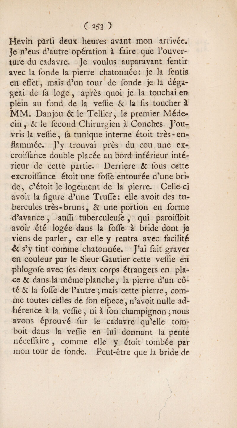 C 2f)3 ) Hevin pârti deux heures avant mon arrivée. Je n’eus d’autre opération à faire que l’ouver¬ ture du cadavre. Je voulus auparavant fentir avec la fonde la pierre chatonnée : je la fentis en effet, mais d’un tour de fonde je la déga¬ geai de fa loge , après quoi je la touchai en plein au fond de la veffie & la fis toucher à MM. Danjou & le Tellier, le premier Méde¬ cin , & le fécond Chirurgien à Conches- J’ou¬ vris la veffie, fa tunique interne étoit très-en¬ flammée. J’y trouvai près du cou une ex- croiffance double placée au bord inférieur inté¬ rieur de cette partie. Derrière & fous cette excroiflànce étoit une foffe entourée d’une bri¬ de, c’étoit le logement de la pierre. Celle-ci avoit la figure d’une Truffe: elle avoit des tu¬ bercules très-bruns, & une portion en forme d’avance, auffi tuberculeufe, qui paroiffoit avoir été logée dans la foffe à bride dont je viens de parler, car elle y rentra avec facilité & s’y tint comme chatonnée. J’ai fait graver en couleur par le Sieur Gautier cette veffie en phlogofe avec fes deux corps étrangers en pla¬ ce & dans la même planche, la pierre d’un cô¬ té & la foffe de l’autre , mais cette pierre, com¬ me toutes celles de fon efpece, n’avoit nulle ad¬ hérence à la veffie, ni à fon champignon ;nous avons éprouvé fur le cadavre qu’elle tom- boit dans la veffie en lui donnant la pente nécefîaire , comme elle y étoit tombée par mon tour de fonde. Peut-être que la bride de