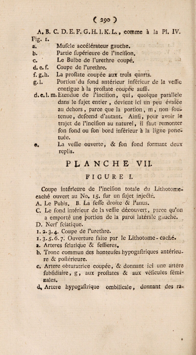 I C 29° } A. B. C. D. E. F. G. H. I. K. L., comme à la PI. IV. Fig. 1. a. Mufcle accélérateur gauche. b. Partie fupérieure de Pincifion. c. ' Le Bulbe de I’urethre coupé. d. e. f. Coupe de l’urethre. f. g. h. La proftate coupée aux trois quarts. g. l. Portion du fond antérieur inférieur de la veille contiguë à la prohate coupée aulfi. d.e.l. m« Etendue de l’incifion, qui, quoique parallèle dans le fujet entier , devient ici un peu évaifée au dehors, parce que la portion, m, non fou- tenue, defcend d’autant. Ainfi, pour avoir le trajet de l’incifion au naturel, il faut remonter fon fond ou fon bord inférieur à la ligne ponc- tuée. La veffie ouverte, & fon fond formant deux replis. planche VII. FIGURE I. Coupe intérieure de l’incifion totale du Lithotome- caché ouvert au No. 15. fur un fujet injedié. A. Le Pubis. B. La fefie droite & l’anus. C. Le fond intérieur de la veille découvert, parce qu’on a emporté une portion de la paroi latérale gauche. D. Nerf fciatique. 1.2.3.4, Coupe de l’urethre. 1.3.5.6.7. Ouverture faite par le Lithotome - caché. 2. Arteres fciatique & felheres. b. Tronc commun des honteufes hypogahriques antérieu¬ re & pofiérieure. c. Artere obturatrice coupée, & donnant ici une artere fubfidiaire, g, aux profiates & aux véficules fé mi¬ nâtes. 4* Artere hypogaftrique ombilicale, donnant des ra-