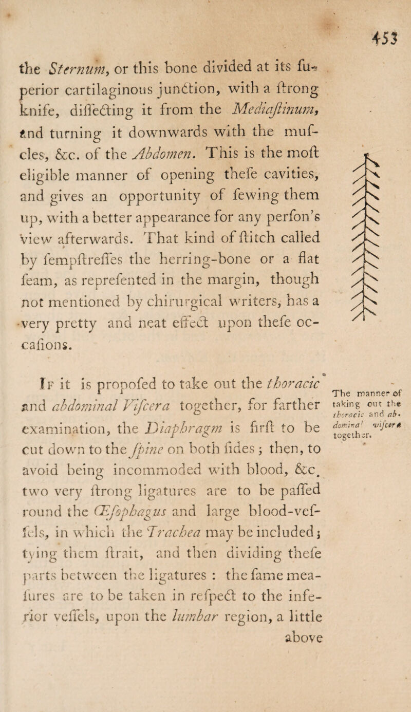 4 S3 the Sternum, or this bone divided at its lu- perior cartilaginous junction, with a llrong knife, diffedting it from the Mediaflinum, tnd turning it downwards with the muf- cles, &c. of the Abdomen. This is the moft eligible manner of opening thefe cavities, and gives an opportunity of fewing them up, with a better appearance for any perfon’s View afterwards. That kind of flitch called by fempftrefles the herring-bone or a flat feam, as reprefented in the margin, though not mentioned by chirurgical writers, has a •very pretty and neat effect upon thefe oc- calions. * ® If it is propofed to take out the thoracic and abdominal Vifcera together, for farther examination, the Diaphragm is fir ft to be cut down to thtfpine on both tides ; then, to avoid being incommoded with blood, &c# two very ftrong ligatures are to be pafled round the CEfopbagus and large blood-vef- fcls, in which the kTrachea may be included \ tying them ftrait, and then dividing thefe parts between the ligatures : the fame mea- iures are to be taken in refpedt to the infe¬ rior veifels, upon the lumbar region, a little above The manner of taking out the thoracic and ah» dom'vna1 wfcert together.