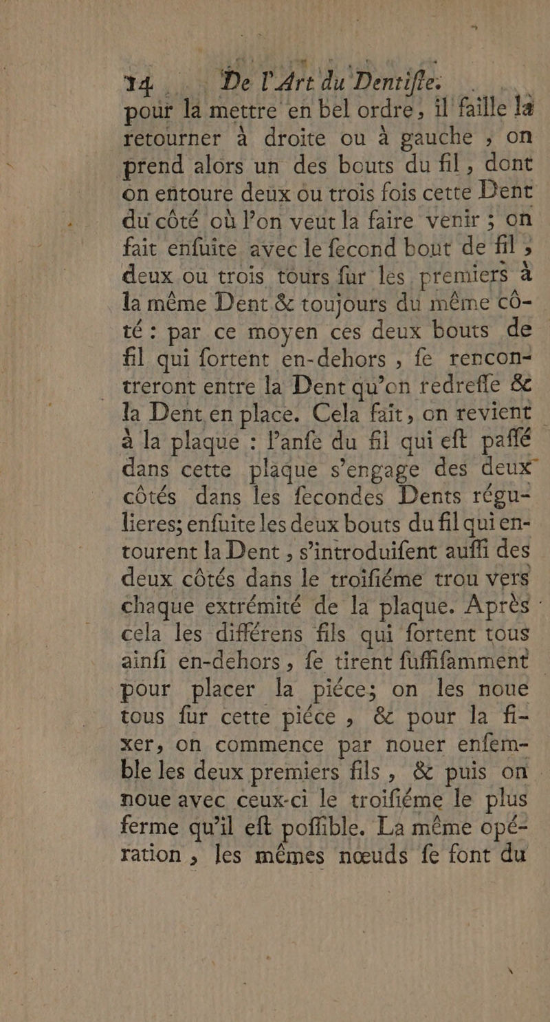 LA Lie: 34 De l'Art du Dentifie. AW pour là mettre en bel ordre, il faille la retourner à droite ou à gauche ; on prend alors un des bouts du fil, dont on entoure deux ou trois fois cette Dent du côté où l’on veut la faire venir ; on fait enfuite avec le fecond bout de fil ; deux ou trois tours fur les premiers à la même Dent &amp; toujours du même cô- té: par ce moyen ces deux bouts de fil qui fortent en-dehors , fe rencon- treront entre la Dent qu’on redrefle &amp; la Denten place. Cela fait, on revient à la plaque : Panfe du fl quieft paflé dans cette plaque s'engage des deux” côtés dans les fecondes Dents régu- lieres; enfuite les deux bouts du filquien- tourent la Dent , s’introduifent aufli des deux côtés dans le troifiéme trou vers chaque extrémité de la plaque. Après : cela les différens fils qui fortent tous ainfi en-dehors, fe tirent fuffifamment pour placer la piéce; on les noue tous fur cette piéce , &amp; pour la fi- xer, on commence par nouer enfem- ble les deux premiers fils, &amp; puis on. noue avec ceux-ci le troifiéme le plus ferme qu’il eft poffible. La même opé- ration ; Jes mêmes nœuds fe font du