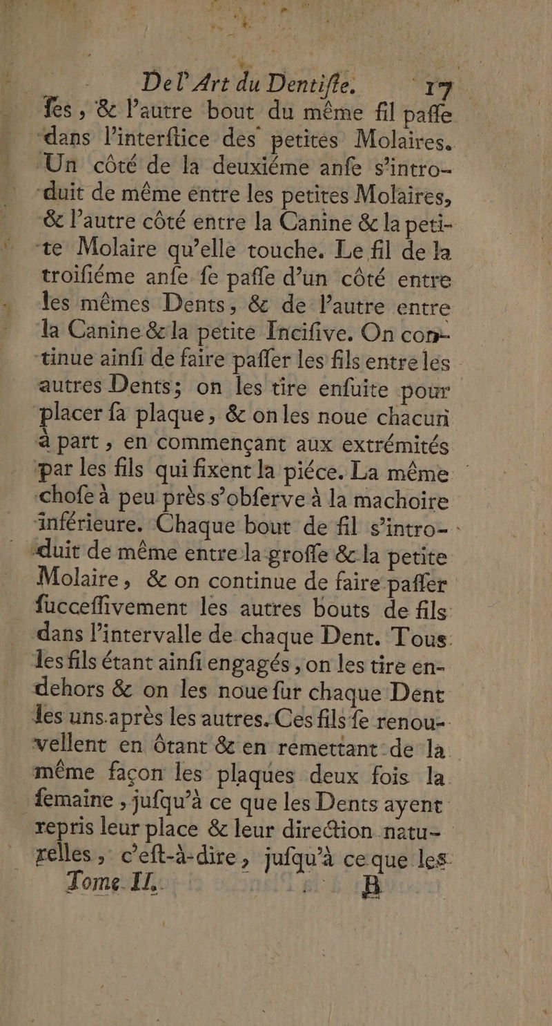 += : Del Ai du Dentifle. 17 | fes , &amp; l’autre bout du même fil pañle 6e l’autre côté entre la Canine &amp; la peti- troifiéme anfe fe pañle d’un côté entre les mêmes Dents, &amp; de lPautre entre la Canine &amp; la petite Incifive. On con- autres Dents; on les tire enfuite pour Molaire, &amp; on continue de faire pañler fucceflivement les autres bouts de fils dans l’intervalle de chaque Dent. Tous: es fils étant ainfi engagés , on les tire en- vellent en Ôtant &amp; en remettant de la même façon les plaques deux fois la. repris leur place &amp; leur direction netu- relles, c’eft-à-dire, jufqu’à ce que les: Tome. IL, pi ; fe]