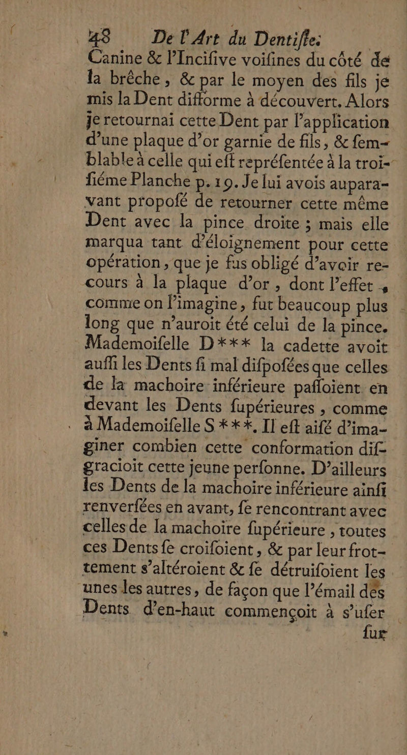 Canine &amp; lIncifive voifines du côté de la brêche, &amp; par le moyen des fils je mis la Dent difforme à découvert, Alors Je retournai cette Dent par l’application d’une plaque d’or garnie de fils, &amp; fem= blable à celle qui eft repréfentée à la troi- fiéme Planche p. 19. Je lui avois aupara- vant propoié de retourner cette même Dent avec la pince droite ; mais elle marqua tant d’éloignement pour cette opération, que je fas obligé d’avoir re- cours à la plaque d’or, dont l'effet , comme on limagine, fut beaucoup plus long que n’auroit été celui de la pince. Mademoifelle D*X** la cadette avoit auffi les Dents fi mal difpofées que celles de l machoire inférieure pañloient. en devant les Dents fupérieures , comme à Mademoifelle S ***, Il eft aifé d’ima- giner combien cette conformation dif gracioit cette jeune perfonne. D'ailleurs les Dents de la machoire inférieure ainfi renverfées en avant, {e rencontrant avec celles de Ia machoire fupérieure , toutes ces Dents fe croifoient , &amp; par leur frot- tement s’altéroient &amp; fe détruifoient les unes les autres, de façon que l’émail dés Dents d’en-haut commençoit à sufer fur