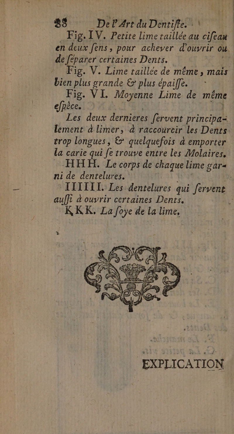 Fig. IV. Petite lime raillée au cifeau en deux fens, pour achever d'ouvrir où. de Jéparer certaines Dents. - Fig. V. Lime taillée de même, mais bien plus grande &amp; plus épaife. Fig. VL Moyenne Lime de même efpèce. | Les deux dernieres fervent Din LiDE lement a limer, à raccourcir Les Dents: trop longues, &amp;* quelquefois à emporter la carie qui fe trouve entre les Molaires. HHH. Le corps de chaque lime gar= ni de dentelures. ITITIT. Les dentelures qui fervent aufft à ouvrir certaines Dents. KRKK, La foye de la lime, EXPLICATION