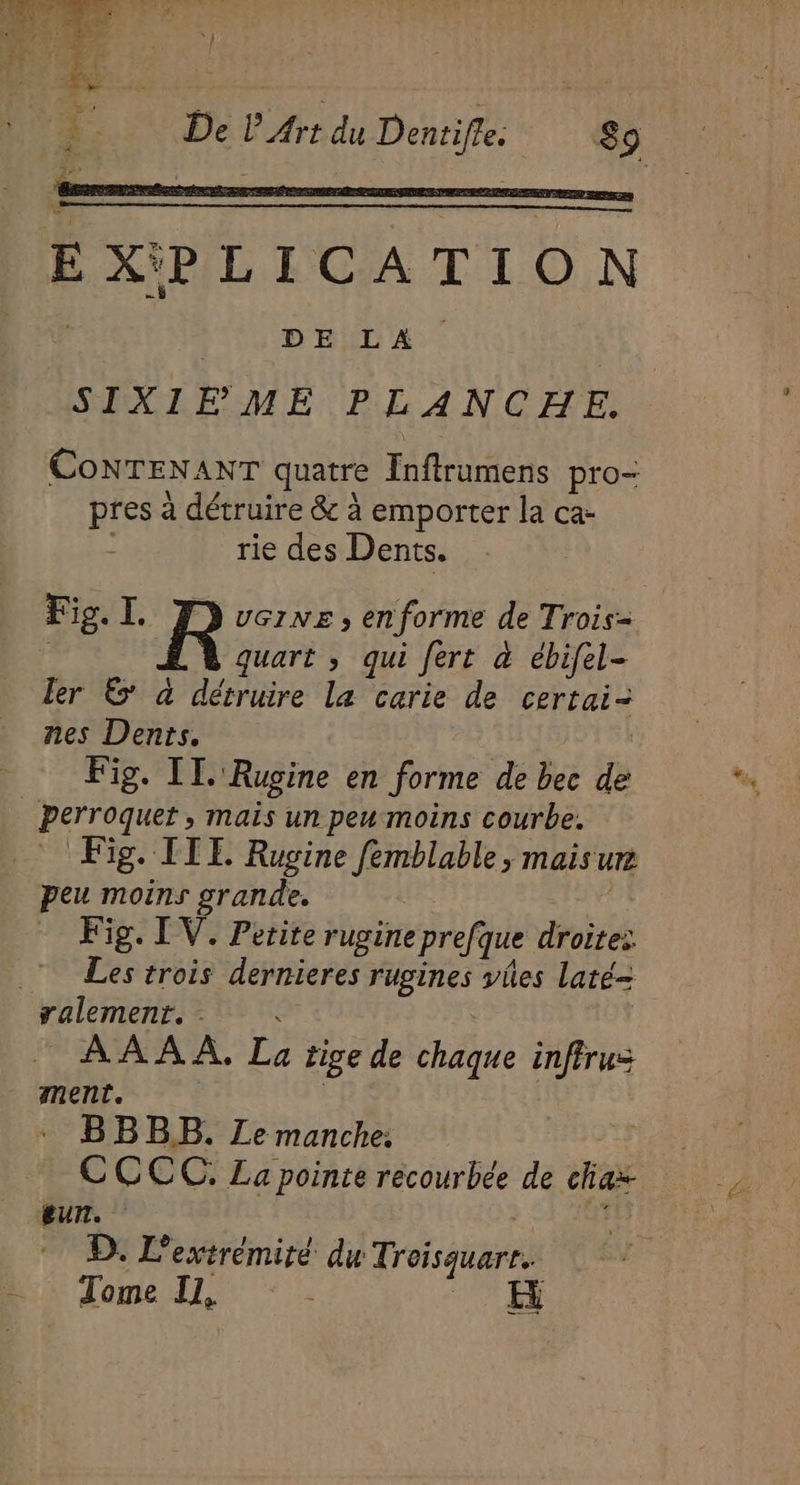 EXPLICATION | | DE LA SIXIFEME PLANCHE. CONTENANT quatre Inftrumens pro- pres à détruire &amp; à emporter la ca- rie des Dents. Fig. I. R UGINE » enforme de Trois= ; quart ; qui fert à ébifel- ler 6 à détruire la carie de certai- nes Dents. | Fig. IT. Rugine en forme de bec de | perroquet, mais un peu moins courbe. Fig. IIE Rugine femblable, maisur peu moins grande. Fig. LV. Petite rugineprefque droites Les trois dernieres rugines vies laté= ralement. . ©” AAAAÀ, La tige de chaque inffrus ment. | BBBLB. Ze manche: | CCCC. La pointe récourbée de cliaz eur. &gt;: 5 D. L’extrémité du Troisquarr. “ Tome Il, « FH