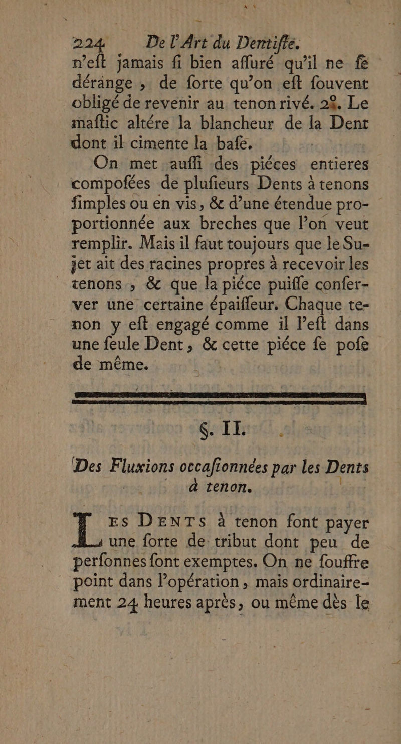 A) 224 Del’ Art du Dentiffe. dérange ; de forte qu’on eft fouvent obligé de revenir au tenonrivé. 28. Le maftic altére la blancheur de la Dent dont il cimente la bafe. On met aufli des piéces entieres compofées de plufieurs Dents à tenons fimples ou en vis, &amp; d’une étendue pro- portionnée aux breches que l’on veut remplir. Mais il faut toujours que le Su- jet ait des racines propres à recevoir les tenons , &amp; que la piéce puifle confer- ver une certaine épaifleur. Chaque te- non y eft engagé comme il left dans une feule Dent, &amp; cette piéce fe pofe de même. #. $ IL . Des Fluxions occafionnées par les Dents | | à tenon. res i Es DENTS à tenon font payer une forte de tribut dont peu de perfonnes font exemptes. On ne foufre point dans lopération, mais ordinaire- ment 24 heures après, ou même dès le