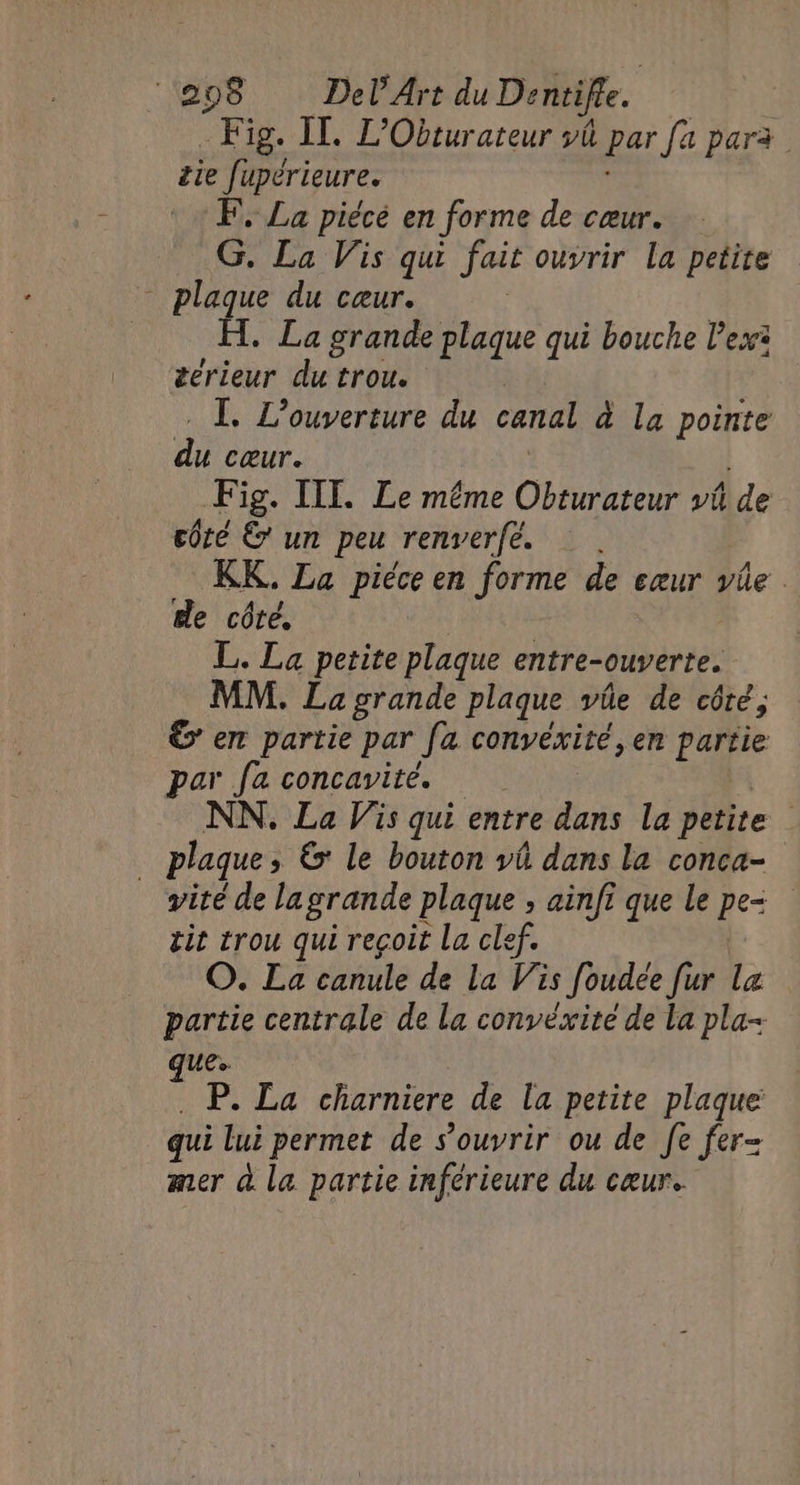 Fig. IL. L’Obturateur vû par fa para tie fupérieure. F, La piécé en forme de cœur. G. La Vis qui fait ouvrir la petite - plaque du cœur. | H. La grande plaque qui bouche lex: éerieur du trou. . L. L'ouverture du canal à la pointe du cœur. | | Fig. IIT. Le même Obturateur vi de côté € un peu renverfé. KK. La piéce en forme de cœur vüe de côté. | L. La petite plaque entre-ouverte. MM. La grande plaque vûe de côté, € en partie par [a convéxité, en partie par fa concavité. | NN. La Vis qui entre dans la petite _ plaque, 6: le bouton vü dans la conca- vité de lagrande plaque ; ainfi que le pe= tit trou qui reçoit La clef. O. La canule de La Vis foudée [ur la partie centrale de La convéxite de La pla- que . P. La charniere de la petite plaque qui lui permet de s'ouvrir ou de fe fer mer à la partie inférieure du cæur.