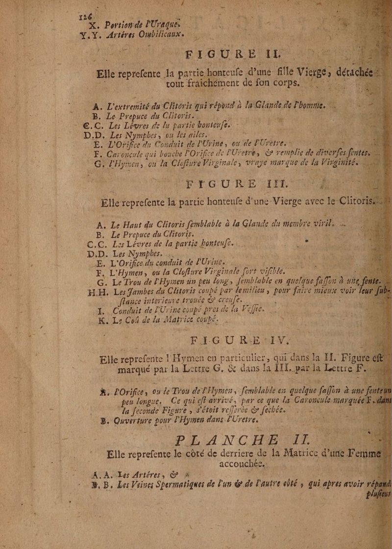À ET D X. Portionde PUTAINE 0 s 70) Y.Y. Artéres Ombiicaux ud. oL ER) RÉ ioc gu d D RE aps RPM. d Elle reprefene. * partie bonteufe. Pon fille vi, dea : tout fraic iément de fon dee d x jii M oe ENTRE b MAD reiter du y linari is qui répord à á 7. Gland de Phone «eh um P B. Le Prepuce du Clitoris. | Mo (00€. C. Les Lévres de lu partie bonteufes - x | p ric PER - C .D. Les Nymphes, ou Pes ailes ag er AE Ms E. L'Orifce de Conduit de l'Urine y ou de EU: dress On NR F. Caroncule qui boucbe l'Orifce dc l'Ufetres &amp; remplie de diverfes feit Mr  A HON uu la cu Virginale, vraye mar que Ji la Ré à RE IGURE in d * : X b Haut du Clitoris fimblable à à la Gland: Ar membre vi inl. B. Le Prepuce du Clitoris. — | C.C. Las Lévres de la partie honteufe.. … à Lo m 2^ : | D.D. Les Nymphes. … : RE ; - SE. L'Orifice. du conduit de PUrine. — Mesas Je ria F. L'Hymen , ou la Cloflure Virginale fort vif ble oek 5 6 Le Trou de /' Hymen un peu long, Jemblable en quelg que. filo à à. p j Pr H.H. Les fambes du Clitoris coupé par fe milieu y Pur di v mieux voir Veur IE fauce intevieuve trouce &amp; ereufe. SMS uj + Y. Conduit de l'Urine coupé pres de fa Ve 1L AN | : K. Ls Co de la Marr. ice coupés d CS KB ee FI GU Rb: 1V. : Elle reprefente | Y Hymen en particulier, qui “dans sla Hs Fou : marque par la Loue G, &amp; dans la i. par M LeueF 2 fe Ü &amp;. lOrifice, ou le Trou de Hymen femblable en ba fuffisà à une pen longue, Ce qui eff avrivé, par ce que la Caromule mar ranke i e A la feconde Figure , s'étoit vejzrée c» fechée. von i. B. Ouverture DA Hymen dans PUretre, en dts he dur PEN CBE yd f VMS reprefente le côté de derriere de la Maurice zwe F Fe dE M accouchés. 4 : i Or A. A. Yes Artéres, suc | MA DL. UC 00