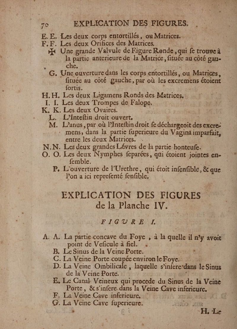 E. E. Les deux corps entortillés, ou Matrices. EF. F. Les deux Orifices des Mauices.: | | Une grande Valvule de Figure Rende , qui fe trouve à | la partie anterieure de la Matrice, fituée au côté gau- - che. fituée au côté gauche, par où les excremens étoient fortis. : H.H. Les deux Ligamens Ronds des Matrices. I. I. Les deux Trompes de Falope. 4 K. K. Les deux Ovaircs. L. L’Inteftin droit ouvert. M. L’anus, par où l'Inteftin droit fe déchargeoit Hs excre- - mens, dans la partie fuperieure du Vagina imparfait, entre les deux Matrices. N.N. Les deux grandes Lévres de la partie honteufe. O. O. Les deux Nymphes feparées, qui étoient jointes ens femble. P, L'ouverture de l'Urethre, qui étoit infenfible, & que Pon a ici reprefenté fenfble, EXPLICATION DES FIGURES de la Planche IV. .— re Mon ape 74 À. A. La partie.concave du Foye , à la cdi il n'y avoit | point de Veficule à fiel. , B. Le Sinus de la Veine Porte. C. La Veine Porte coupée environ le Foye. D. La Veine Oinbilidade , laquelle s’iniere ‘dans k Sinus de la Veine Porte. | E‚ Le Canal Veineux qui procede du Sinus de la Veine Porte, &s’infere. dans la Veine Cave bee | F. La Véine Cave inferieure, .— ward e dl G. La Veine Cave fupcrieure. los AUR » € | HL Le