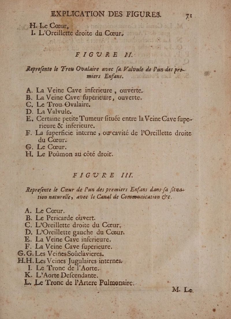 I. L'Oreilk M üoite du Cœur, FIGURE 21: Reprefente le Fron Ovalaire avec [a Valonle «i Pan: vi e miers Enfans. A. La Veine Cave inferieure , ouverte, B. La Veine Cave: fupérieure , ouverte. .€, Le Trou: Ovalaire. D. La Valvule. E. Certaine petite Tumeur fituée entre la Veine Càve fupe- rieure & inferieure. F. La fuperficie interne , ou*cavité de POreillette droite | du Cœur: G. Le Cœur. H. Le Poümon au côté droit. FIGGQ' RS. II. Reprefente le Cœur de Pun des premiers Enfans dans-fa fta — tion naturelle, avec le Canal de Communication (c, A. Le Cœur. B. Le Pericarde ouvert. D. L’Oreillette gauche du Cœur, E. La Veine Cave inferieure. F. La Veine Cave fuperieure. G.G. Les VeinesSoûclavieres. ELH. Les Veines Jugulaires internes: I. Le Tronc de l’Aorte.. K. L’Aorte Defcendante. m Ee, Le Tronc de PArtere Paulmonairc.. — E M. Le. Gui p