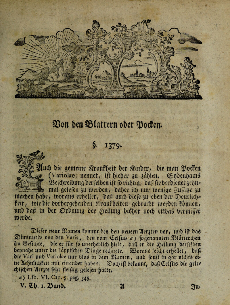 Wr S3on bcn Sölattem o&cr $ocfett. §• 1379- 3Tttc& bie gemeine SttanFfjeit bet $inbct/ bie man ^oefett (Variolae; nennet/ ift bict)cf ju sagten. <gi)beut)iim» SBeiCftreibung beleihen ift fo richtig. tag ftebabienctöhit- mal gelcfen ju Werben/ bähet* ich nur wenige gufeije $u machen habe, worauf erhellet/ ba§ auch biefe ju eben ber ©ctiflici)* Feit/ Wie bie borf)crgei)cnbcu .f'rauffeiten gebracht werben fernnen/ unb bap in bet -Orbnung bet -peilung bibt)cr noch etwa» bermiffet Werbe. ©leter neue Stamen fonnnt bet) beit neuern Tierjfen bor/ ltttb fft bn$ ©iminutiv eon ben Varis, ten »ein \[eifue a; fogenannten SÖlätterWen im ©efiebte, bie er für fo unerheblich hielt/ bah er bie Teilung ber feiten beinahe unter bie lappifeben ©inge rechnete. SBorcniP !eid;t erhellet/ ba(j bie Vari unb Vanolae nur bloö in Seni Stamen, unb feuft iit gor ntdjf«? ei« tteTlehnlid/feit mit einonber habe*. ©Oihijibefannf/ ba(s£cifu9 bie grte* ehifeijen tlerjte fehc (Jei(?ig gelefen (taKf* <*) Lib. VI, Cap. 5. p3g. 345.