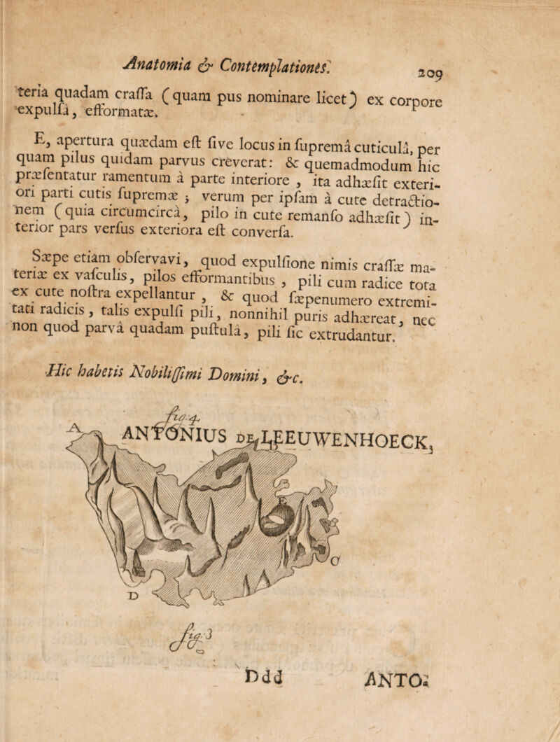 teria quadam crafta ( quam pus nominare licet expulfa, efformatx. 209 ex corpore E, apertura quaedam eft five locus in fuprema cuticula, per quam pilus quidam parvus creverat: & quemadmodum hic prxlentatur ramentum a parte interiore , ita adhxfit exteri¬ ori parti cutis fupremx j verum per ipfam a cute detraftio- nem ( quia circumcirca, pilo in cute remanfo adhxfit ) in¬ terior pars verius exteriora eft converfa. J Saepe etiam obfervavi, quod expulfione nimis craftx ma- tenx ex vafculis, pilos efformantibus , pili cum radice tota ex cute noftra expellantur , & quod fxpenumero extremi¬ tati radicis , talis expulfi pili, nonnihil puris adhxreat, non quod parva quadam puftula, pili fic extrudantur. nec ■Hic habetis Ivobiliflimi Domini, <&c. Ddd ANTOi