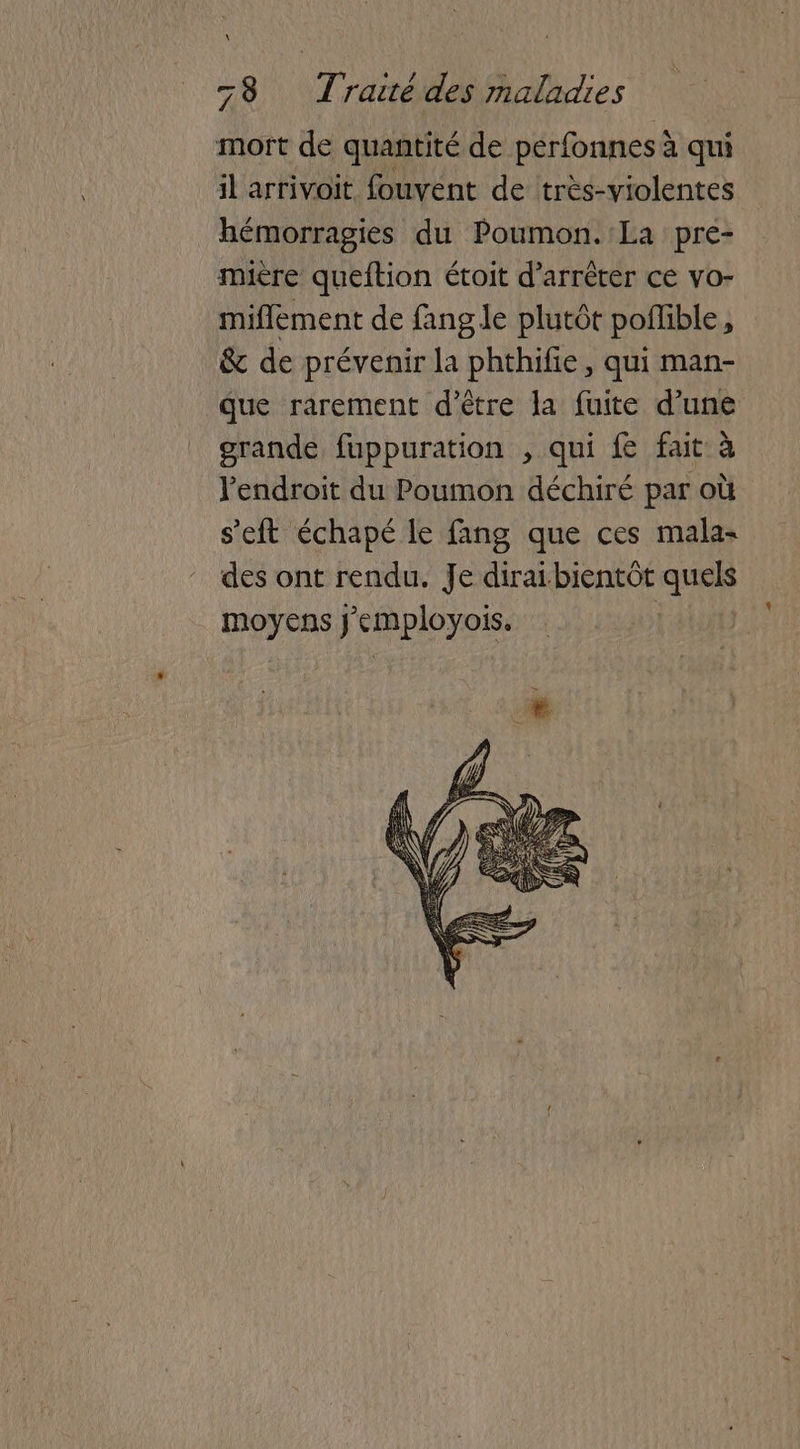 mort de quantité de perfonnes à à qui il arrivoit fouvent de très-violentes hémorragies du Poumon.'La pre- mière queftion étoit d'arrêter ce vo- miflément de fang le plutôt poflible j & de prévenir la phthifie, qui man- que rarement d’être la fuite d’une grande fuppuration , qui fe fait à l'endroit du Poumon déchiré par où s’eft échapé le fang que ces mala des ont rendu. Je dirai bientôt es moyens j Moi