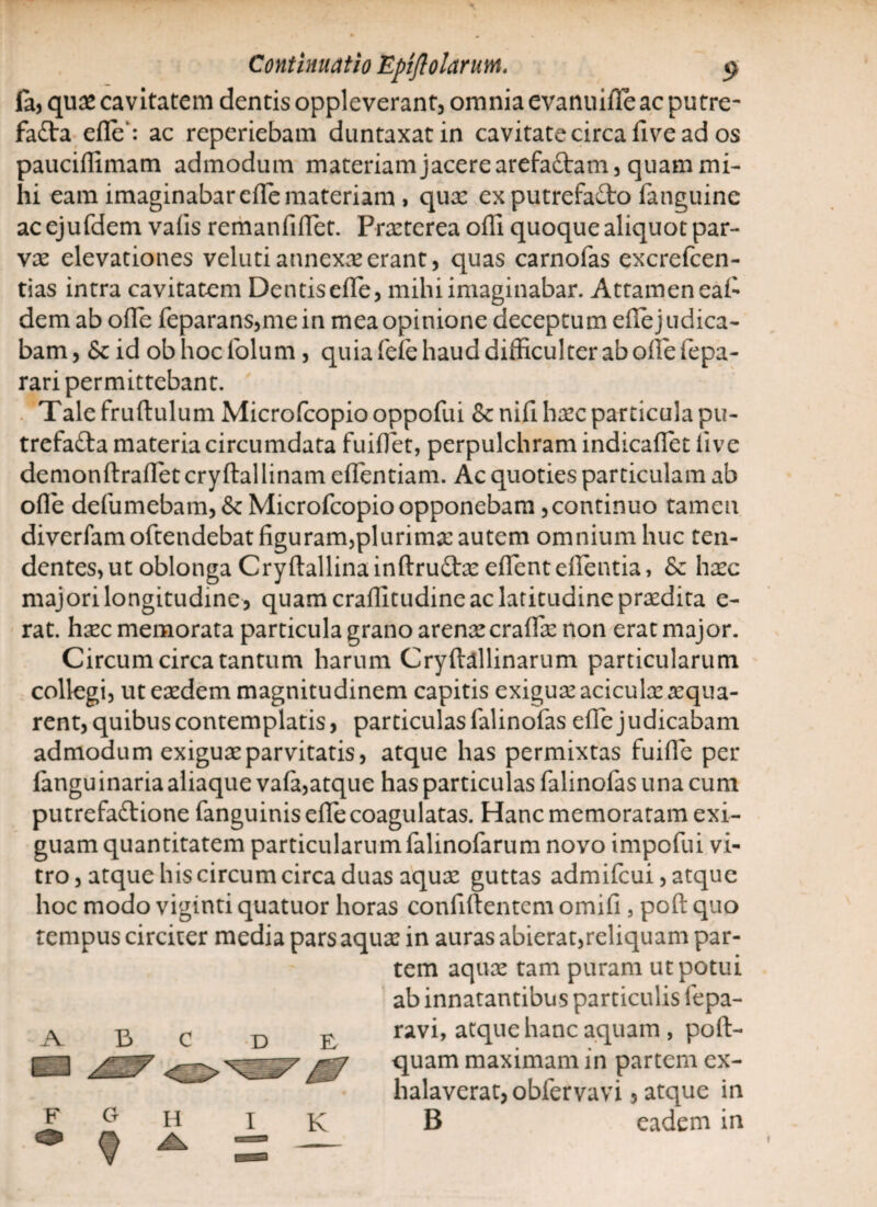fa, quae cavitatem dentis oppleverant, omnia evanuide ac putre¬ facta ede': ac reperiebam duntaxatin cavitate circa live ad os paucidimam admodum materiam jacere arefaCtam, quam mi¬ hi eam imaginabar ede materiam , quae ex putrefaCto fanguine ac ejufdem valis remanfidet. Praeterea odi quoque aliquot par¬ vae elevationes veluti annexae erant, quas carnofas excrefcen- tias intra cavitatem Dentis ede, mihi imaginabar. Attameneal- dem ab ode feparans,me in mea opinione deceptum ede j udica- bam, & id obhocfolum , quia fele haud difficulter ab ode fepa- rari permittebant. Talefrudulum Microfcopiooppofui & nili haec particula pu- trefafta materia circumdata fuidet, perpulchram indicadet live demonftradet crydal linam edentiam. Ac quoties particulam ab ode defumebam,&Microfcopioopponebam,continuo tamen diverfam oftendebat figuram,plurima: autem omnium huc ten¬ dentes, ut oblonga CryftallinainftruCtx edent edentia, & haec majori longitudine, quam craditudine ac latitudine praedita e- rat. haec memorata particula grano arenaecraflae non erat major. Circumcirca tantum harum Crydallinarum particularum collegi, ut eaedem magnitudinem capitis exiguae aciculae aequa¬ rent, quibus contemplatis, particulas falinofas ede judicabam admodum exiguae parvitatis, atque has permixtas fuide per langu inaria aliaque vala,atque has particulas falinofas una cum putrefaftione fanguinis ede coagulatas. Hanc memoratam exi¬ guam quantitatem particularumfalinofarum novo impofui vi¬ tro, atque his circum circa duas aquae guttas admifeui, atque hoc modo viginti quatuor horas confidentem omifi , pod quo tempus circiter media pars aquae in auras abierat,reliquam par¬ tem aquae tam puram ut potui ab innatantibus particulis fepa- ravi, atque hanc aquam , pod- quam maximam in partem ex¬ halaverat, obfervavi, atque in B eadem in i