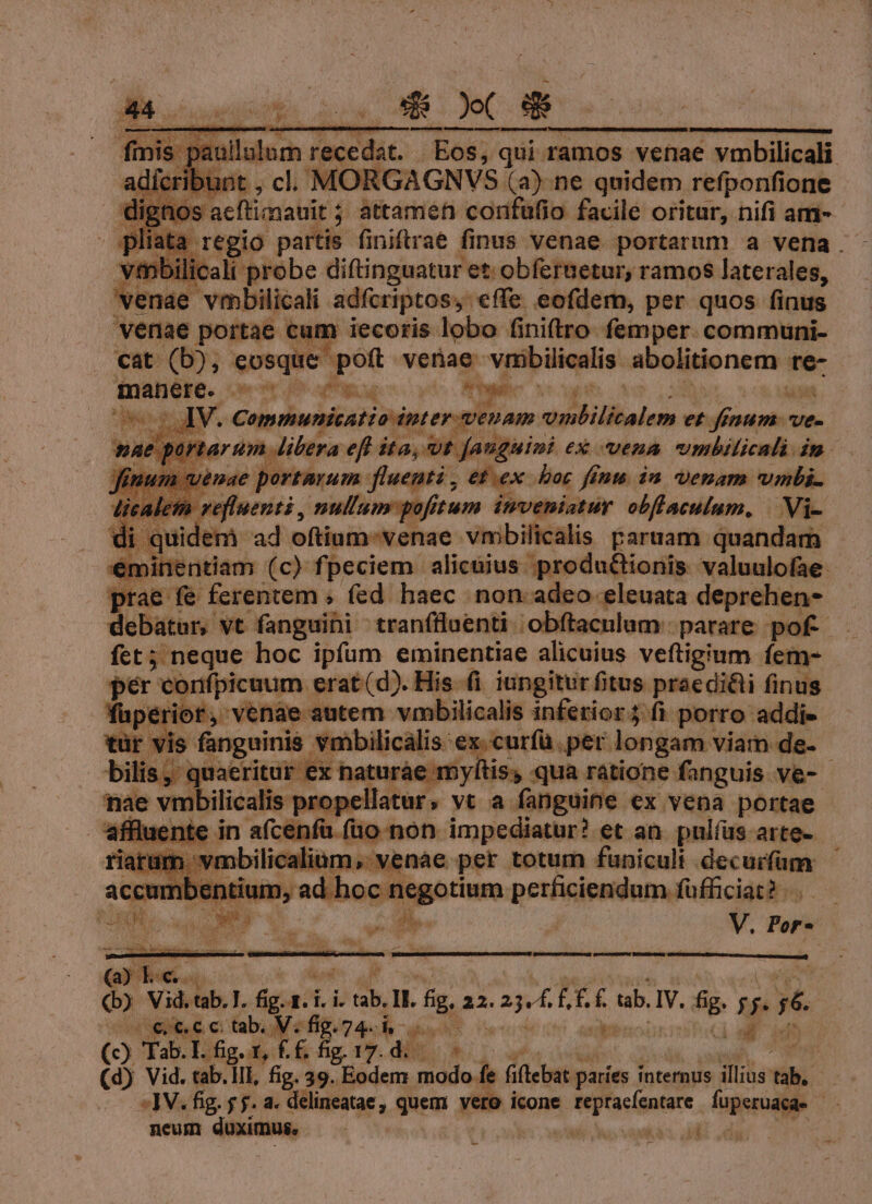 paullulum reced Eos, qui ramos venae vmbilicali ícribunt , cl. ORGAGNVS (a) ne quidem refponfione is ae ftianauit ; j attamen confufio facile oritur, nifi am- yliat: regio partis finiftrae finus venae portarum a vena. vimbilicali probe diftinguatur et obfernetur, ramos laterales, venae vmbilicali adfcriptos, effe eofdem, per quos finus venae portae cum iecoris lobo finiftro femper. communi- cat (b), (apt, E dm venae. vimbilicalis. abolitionem qne- manere. : S ar M m i in a : hy à P $3 S4 » dinem e deal dini. €x ERA earl in. m vem nae portarum fluenti , et.ex bor fina. in venam wvmbi- licaletn efluenti nullam pofitum inveniatur obflaculum, | Vi- di li quidem ad oftium-venae vmbilicalis paruam quandam - €mitnientiam (c) fpeciem alicuius. productionis. valuulofae- prae fé ferentem , fed haec non adeo eleuata deprehen- — debatur, vt fanguini tranfllaenti .obftaculum. parare. pof : fct; neque hoc ipfum eminentiae alicuius veftigium fem- per conifpicuum erat (d). His. fi iungitur fitus praedi&amp;i finus fuperior, venae autem vmbilicalis inferior; fi porro addie tür vis md ta Mies €x.curíü.per longam viam de- - bilis, quae ex haturáe e myltiss qua ratione fanguis ve- »pellatur, vt a fanguine ex vena portae he vmbilicalis Drop! fluente in n afcenfa. curie impediatur? et an. pulíus arte- imbilicalium, venae per totum funiculi decurfum ,ad. an ginpo ri petiiiestinmfafticiótits : ^ D i V. Por- | PR ong M ! (b) Vid. tab. T. m Idi. s. E [3 22.2. Af f. tub. IV. fig. 7 Nos utei e c GaboM «ffgug 4.4 - qo levis Minh m (c) Tab.l.fig.z, ££, fip 17d. E (d) Vid. tab.lII, fig. 39. Eodem modo de fiftebat. paríes internus illius: Yih: ^ -]V. fig. f f. a. delineatae, quem. vero icone. p MPsdaes füperuagie i neum duximus. | TT kas ddl udis. -