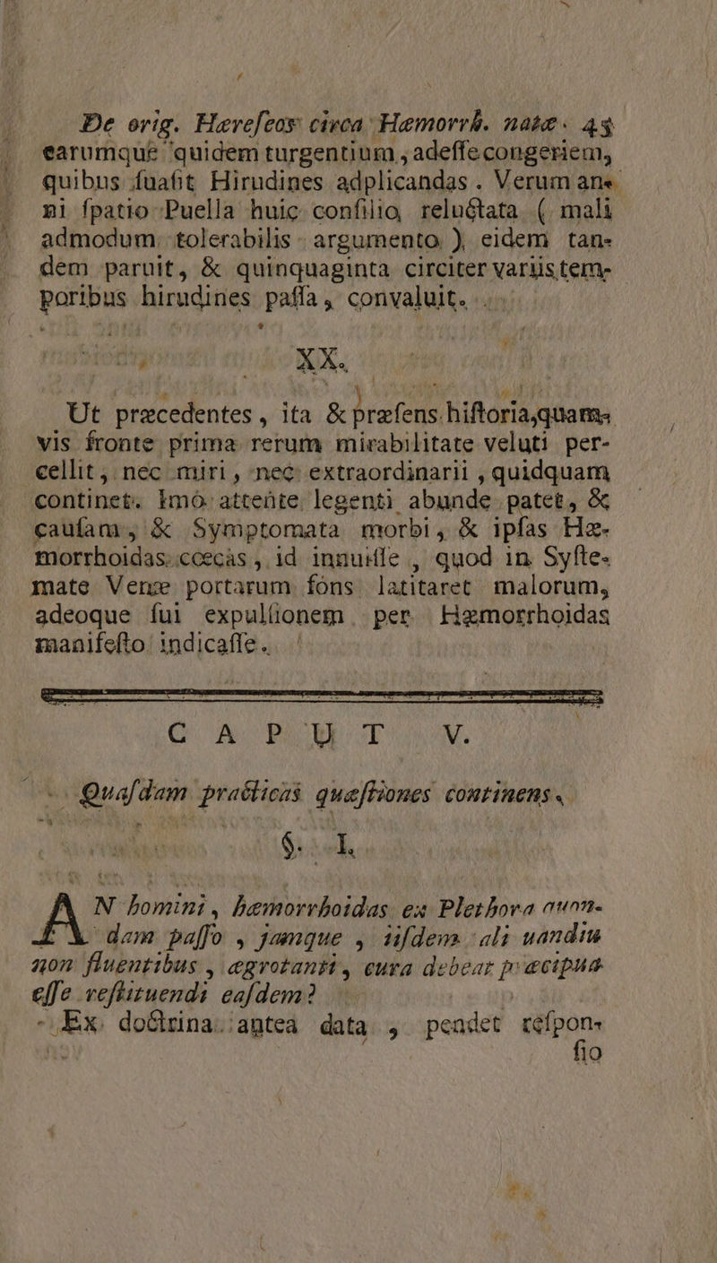 De rig. Hevefeas: civca MSN nahe. 44 earumque quidem turgentium , adeffe congeriem, quibus /fuafit Hirudines adplicandas . Verum an«- nl fpatio Puella huic confilio, reluGtata. (. mali admodum. tolerabilis - argumento), eidem tan- dem paruit, &amp; quinquaginta circiter variis tem- poribus hirudines paffa, convaluit. . » vani. XX. Ut precedentes , ita &amp; Drefeus hiftoriqJgtiate. vis fronte prima rerum mirabilitate veluti per- cellit,; nec miri, nec. extraordinarii , quidquam continet: Imo- attente. legenti. abunde. patet, &amp; caufam, &amp; Symptomata morbi, &amp; ipfas Haz- morrhoidas: €cecas ,.1d. innuife , quod in Syfte. mate Vene portarum fóns latitaret malorum, adeoque íui expulüonem . per Hwinosihioidas manifefto. 1ndicaffe..—' (o Quafdam praélicsá: quefliones continens. N bomini, bemorrboidas. ex Plethora at. dam pa[fo , Jamque , üufdem ali uandim aon fluentibus , egrotanti , eura debear p ecipua eje. veftituendi eafdem? Ede do&amp;hrina.:;antea data , peadet pan, 19