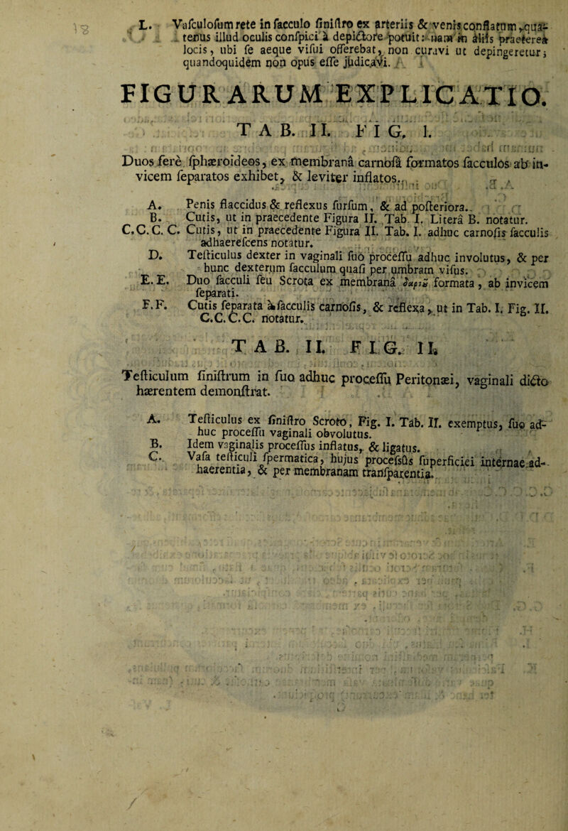 L. Varculofumrete in facculo finiftro ex arteriis &'venhconflattim . tenus illud oculis confpicil depidbre ^pottjit; iiam ki iliis praekrei locis, ubi fe aeque vifui offerebatnon curavi ut depingeretuij quandoquidem nop opus eiffe jiadic^ayi. , J FIGURARU ME X i? LIGAT IO. T A B, I I. F i G, I, 1' ,v , ' ■ . r , i [ ’ ! Duos fere fphaeroideos, ex membrana carnbfi foi-matos facculos ab ia- vicem feparatos exhibet, & leviter inflatos,,,t , * « ii’ C-i. t. A* Penis flaccidus &.reflexus furfum, & ad pofleriora.- . ^ B. Cutis, ut in praecedente Figura IL Tab. I. Litera B. notatur. C.C.C. C. Cutis, ut in praecedente Figura II. Tab. I. adhuc carnofly faeculis adhaerefcens notatur. D. Tefliculus dexter in vaginali fuo proceflu adhuc involutus, Sc per hunc dexterum facculum quafi per,qmbram vifus. £. £• Duo lacculi fbu Scrota ex membxana formata , ab invicem feparati. F. F. Cutis feparata afacculis carnofls, & repexaut in Tab. L Fig. IL C.C.C.C. notatur.. TAB. II, FlG. II» Tefticulum finiftrum in fuo adhuc proceflu Peritonaei, vaginali di^to haerentem demonfti^t. A. B. C. Tefliculus ex flniflro Scroto, Fig. I. Tab. IL exemptus, fuo ad¬ huc proceffii vaginali obvolutus. Idem vaginal^is proceflus inflatus,. & ligatus. Vafa tefticuJi fpermatica, hujus procefsus fuperficiei internaetd**- haeientia, & per membranam tranfpaientif, \