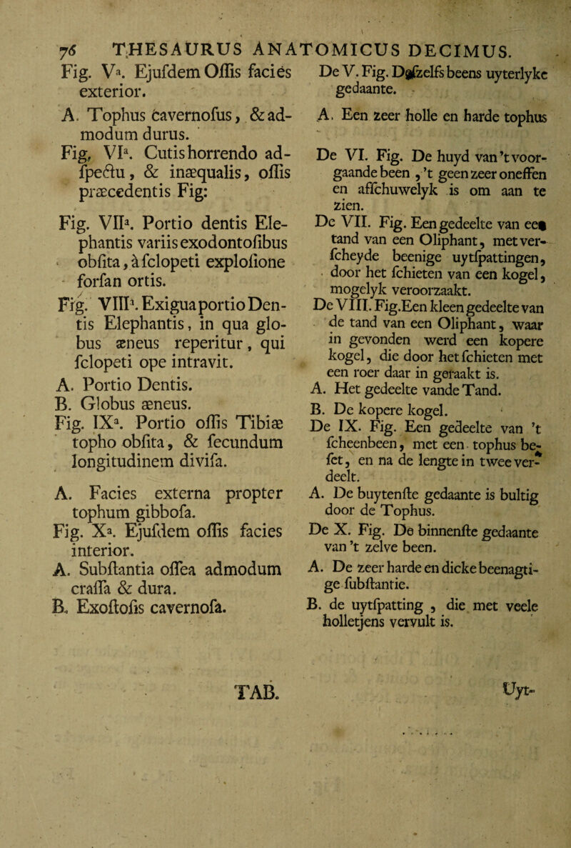 Fig. V». Ejufdem Ollis facies exterior. A. Tophus cavernofus, & ad¬ modum durus. Fig, VI3. Cutis horrendo ad- fpeftu, & inaequalis, ollis praecedentis Fig: Fig. VII3. Portio dentis Ele¬ phantis variis exodontofibus obfita,afclopeti explolione • forfan ortis. Fig. VIII1. Exigua portio Den¬ tis Elephantis, in qua glo¬ bus aeneus reperitur, qui fclopeti ope intravit. A. Portio Dentis. B. Globus aeneus. Fig. IX3. Portio ollis Tibiae topho obfita, & fecundum longitudinem divifa. A. Facies externa propter tophum gibbofa. Fig. X3. Ejufdem ollis facies interior. A. Subllantia oflea admodum cralTa & dura. B. Exoftofis cavernofa. De V, Fig. D|fzelfs beens uy terlykc gedaante. A, Een zeer holle en barde tophus De VI. Fig. De huyd van’tvoor- gaandebeen , ’t geen zeer oneffen en affchuwelyk is om aan te zien. De VII. Fig. Eengedeelte van ee* tand van een Oliphant, metver- Icheyde beenige uytfpattingen, ■ door het fchieten van een kogel, mogelyk veroorzaakt. De VIII. Fig.Een kleen gedeelte van de tand van een Oliphant, waar in gevonden werd een kopere kogel, die door het fchieten met een roer daar in geraakt is. A. Het gedeelte vande Tand. B. De kopere kogel. 1 De IX. Fig. Een gedeelte van ’t fcheenbeen, met een tophus be- let, en na de lengte in twee ver- deelt. A. De buytenfte gedaante is bultig door de Tophus. De X. Fig. De binnenfte gedaante van ’t zelve been. A. De zeer harde en dicke beenagti- ge fubftantie. B. de uytfpatting , die met veele bolletjens vervult is. TAB.