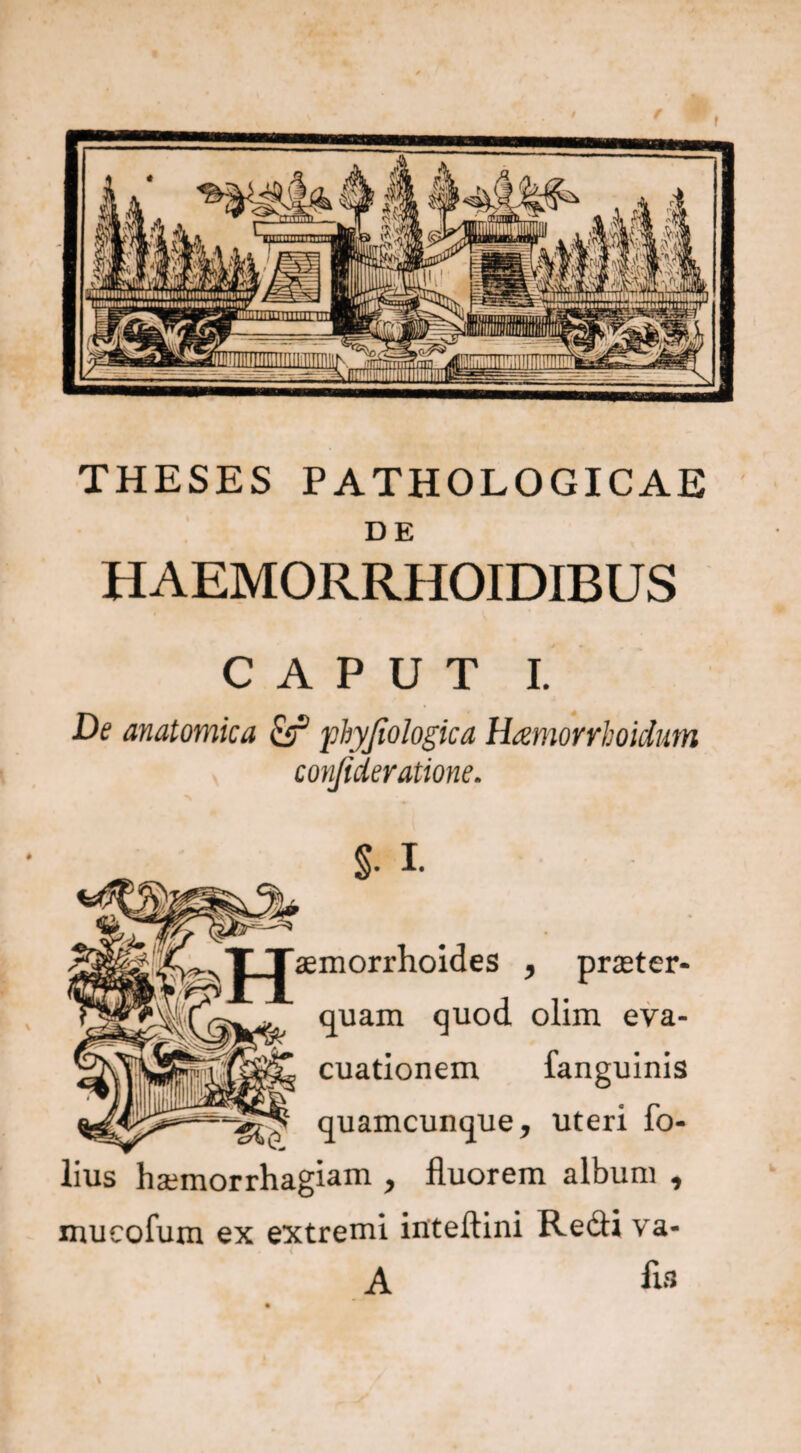 / / r THESES PATHOLOGICAE DE HAEMORRHOIDIBUS caput r. De anatomica & ■phyjiologica Hamorrboidum confideratione. §• I. aemorrhoides , praeter¬ quam quod olim eva¬ cuationem fanguinis quamcunque, uteri fo- lius haemorrhagiam , fluorem album , mucofum ex extremi inteftini Redii va- A fis