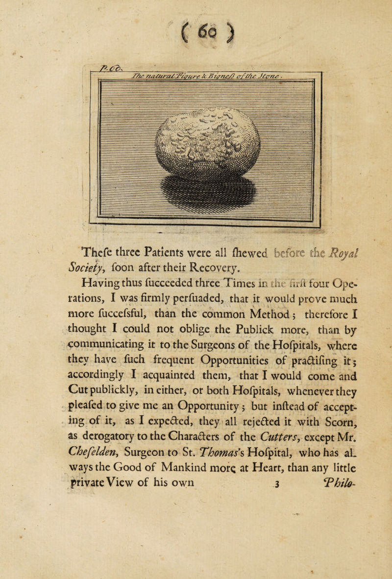 /tMo Thcfe three Patients were all fliewed before the Royal Societyj foon after their Recovery. Having thus fucceeded three Times in the urn tour Ope¬ rations, I was firmly perfuaded, that it would prove much more fuccefsful, than the common Method 5 therefore I thought I could not oblige the Publick more, than by communicating it to the Surgeons of the Hofpitals, where they have fuch frequent Opportunities of praftifing it 5 accordingly I acquainted them, that I would come and Cut publickly, in either, or both Hofpitals, whenever they pleafed to give me an Opportunity 5 but inftead of accept¬ ing of it, as I expected, they all rejected it with Scorn, as derogatory to the Characters of the Cutters, except Mr. Chefelden, Surgeon to St. Thomas's Hofpital, who has al¬ ways the Good of Mankind more at Heart, than any little private View of his own 3 Thilo-