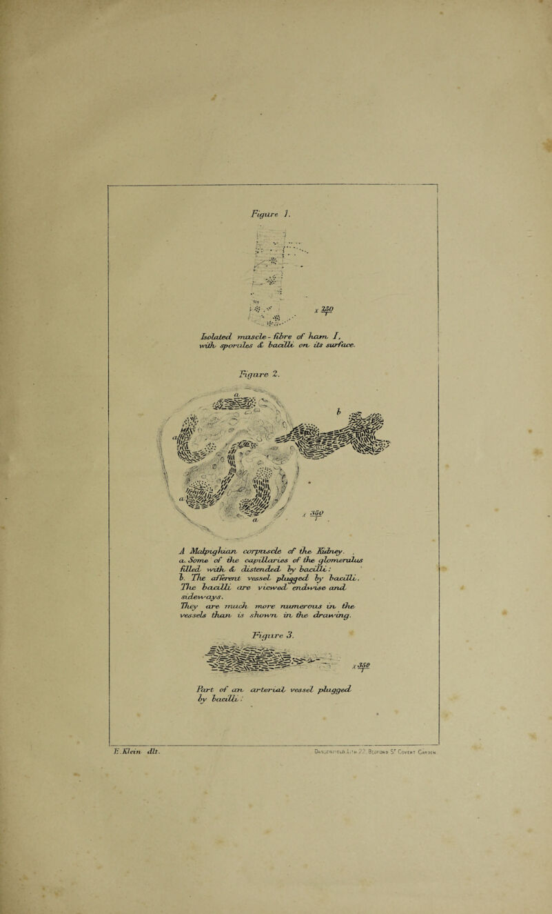 Figure ]. \r '.j Isolated muscle - fibre of ham, I, with* sporides £, bantU, on, its surface. Figure 2. A SlaJtpiglvuin, corpuscle of the Kidney. a. Some of the. capillaries of the, glomerulus filled veith, &, distended by bacilli,: l>. The afferent -vessel plugged by bacilli.. The bacilli, are viewed endwise arid sideways. They are modi more numerous in, the, vessels than, is shown, in, the drawing. Figure 3. Part of an arterial vessel plugged by bacilli, •' h. Klein dlt. Danger,-icl6.L;’h ?2.8toro*o ST Covent Car ten