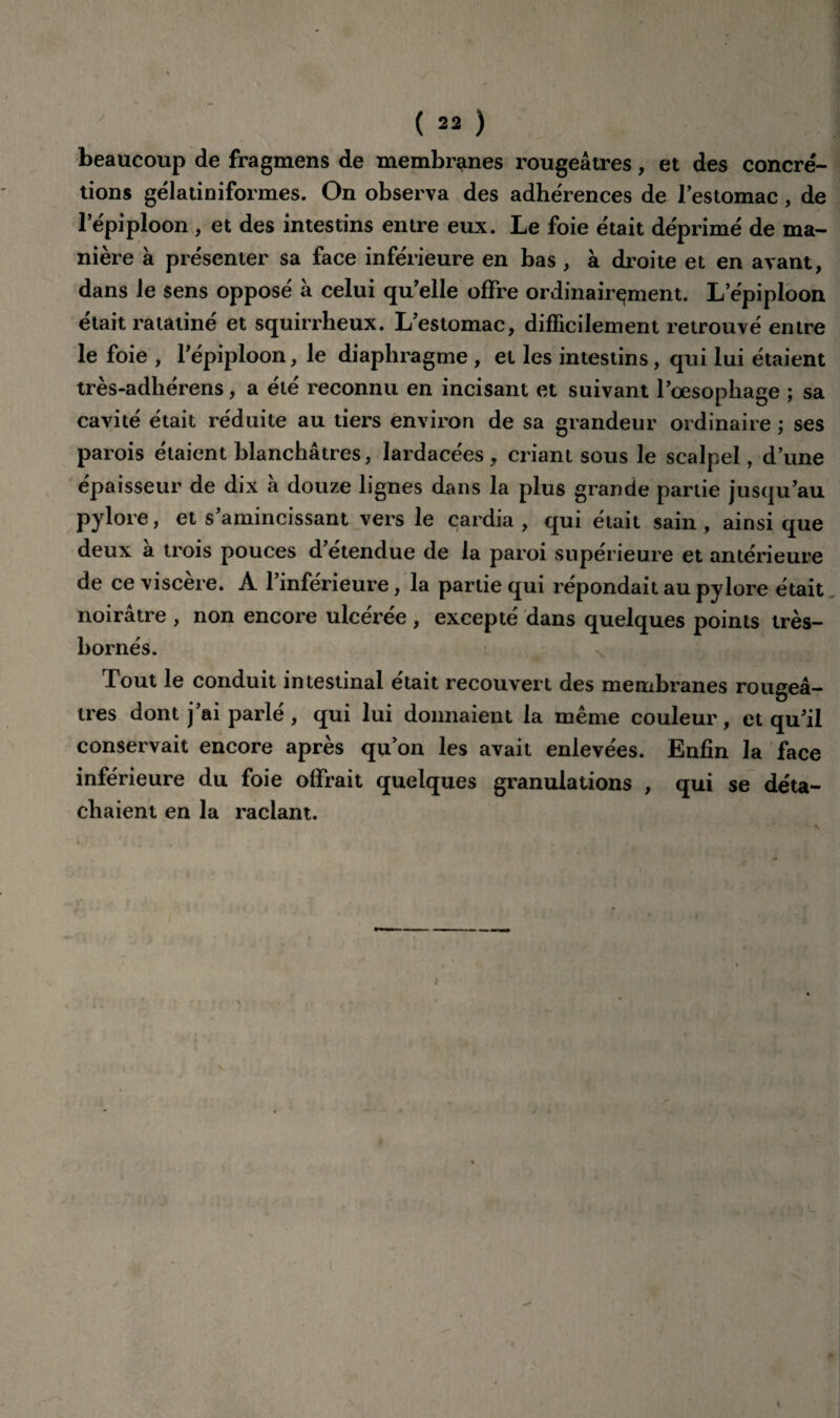 beaucoup de fragmens de membranes rougeâtres, et des concré¬ tions gélatiniformes. On observa des adhérences de [estomac , de l’épiploon , et des intestins entre eux. Le foie était déprimé de ma¬ nière à présenter sa face inférieure en bas , à droite et en avant, dans le sens opposé à celui qu’elle offre ordinairement. L’épiploon était ratatiné et squirrheux. L’estomac, difficilement retrouvé entre le foie , l’épiploon, le diaphragme, et les intestins, qui lui étaient très-adhérens, a été reconnu en incisant et suivant l’oesophage ; sa cavité était réduite au tiers environ de sa grandeur ordinaire ; ses parois étaient blanchâtres, lardacées, criant sous le scalpel, d’une épaisseur de dix à douze lignes dans la plus grande partie jusqu’au pylore, et s’amincissant vers le cardia, qui était sain, ainsique deux a trois pouces d étendue de la paroi supérieure et antérieure de ce viscère. A l’inférieure, la partie qui répondait au pylore était noirâtre , non encore ulcérée , excepté dans quelques points très- bornés. Tout le conduit intestinal était recouvert des membranes rougeâ¬ tres dont j’ai parlé , qui lui donnaient la même couleur, et qu’il conservait encore après qu’on les avait enlevées. Enfin la face inférieure du foie offrait quelques granulations , qui se déta¬ chaient en la raclant.