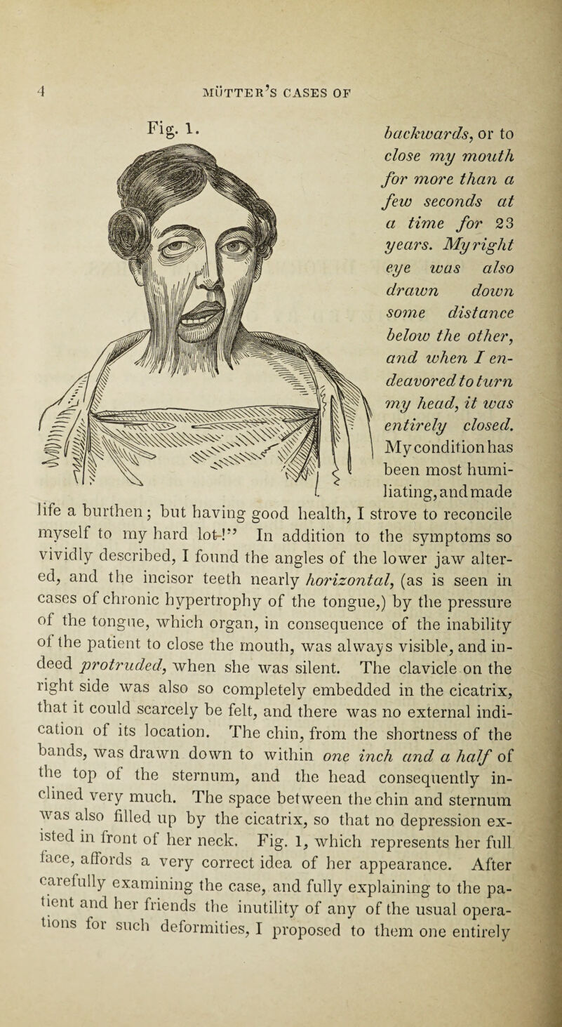 backwards, or to close my mouth for more than a few seconds at a time for 23 years. My right eye was also drawn down some distance beloiu the other, and when I en¬ deavored to turn my head, it was entirely closed. My condition has been most humi¬ liating, and made life a burthen; but having good health, I strove to reconcile myself to my hard lot-!” In addition to the symptoms so vividly described, I found the angles of the lower jaw alter¬ ed, and the incisor teeth nearly horizontal, (as is seen in cases of chronic hypertrophy of the tongue,) by the pressure of the tongue, which organ, in consequence of the inability ot the patient to close the mouth, was always visible, and in¬ deed protruded, when she was silent. The clavicle on the right side was also so completely embedded in the cicatrix, that it could scarcely be felt, and there was no external indi¬ cation ot its location. The chin, from the shortness of the bands, was drawn down to within one inch and a half of the top of the sternum, and the head consequently in¬ clined very much. The space between the chin and sternum was also filled up by the cicatrix, so that no depression ex¬ isted in front of her neck. Fig. 1, which represents her full lace, affords a very correct idea of her appearance. After carefully examining the case, and fully explaining to the pa¬ tient and her friends the inutility of any of the usual opera¬ tions for such deformities, I proposed to them one entirely