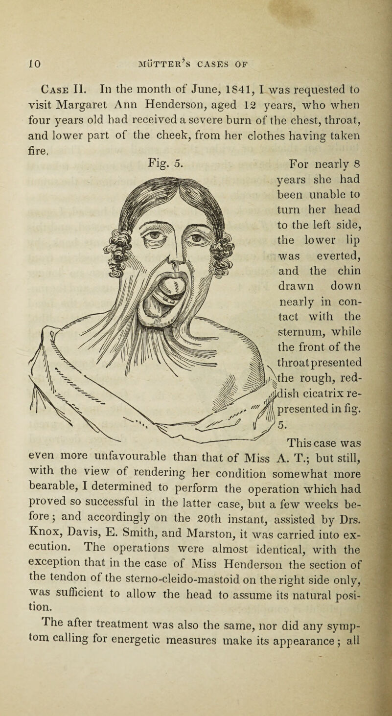 Case II. In the month of June, 1S41, I was requested to visit Margaret Ann Henderson, aged 12 years, who when four years old had received a severe burn of the chest, throat, and lower part of the cheek, from her clothes having taken fire, Fig. 5. For nearly 8 years she had been unable to turn her head to the left side, the lower lip was everted, and the chin drawn down nearly in con¬ tact with the sternum, while the front of the throat presented the rough, red¬ dish cicatrix re¬ presented in fig. '5. This case was even more unfavourable than that of Miss A. T.; but still, with the view of rendering her condition somewhat more bearable, I determined to perform the operation which had proved so successful in the latter case, but a few weeks be¬ fore ; and accordingly on the 20th instant, assisted by Drs. Knox, Davis, E. Smith, and Marston, it was carried into ex¬ ecution. The operations were almost identical, with the exception that in the case of Miss Henderson the section of the tendon of the sterno-cleido-mastoid on the right side only, was sufficient to allow the head to assume its natural posi¬ tion. The after treatment was also the same, nor did any symp¬ tom calling for energetic measures make its appearance; all