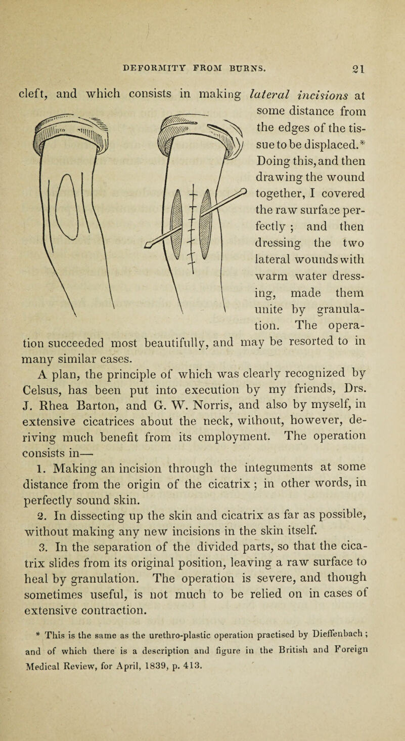 cleft, and which consists in making lateral incisions at some distance from the edges of the tis¬ sue to be displaced.* Doing this, and then drawing the wound together, I covered the raw surface per¬ fectly ; and then dressing the two lateral wounds with warm water dress- ins:, made them ing, made mem unite by granula¬ tion. The opera¬ tion succeeded most beautifully, and may be resorted to in many similar cases. A plan, the principle of which was clearly recognized by Celsus, has been put into execution by my friends, Drs. J. Rhea Barton, and G. W. Norris, and also by myselt, in extensive cicatrices about the neck, without, however, de¬ riving much benefit from its employment. The operation consists in— 1. Making an incision through the integuments at some distance from the origin of the cicatrix ; in other words, in perfectly sound skin. 2. In dissecting up the skin and cicatrix as far as possible, without making any new incisions in the skin itself. 3. In the separation of the divided parts, so that the cica¬ trix slides from its original position, leaving a raw surface to heal by granulation. The operation is severe, and though sometimes useful, is not much to be relied on in cases of extensive contraction. * This is the same as the urethro-plastic operation practised by Dieflenbach ; and of which there is a description and figure in the British and Foreign Medical Review', for April, 1839, p. 413.