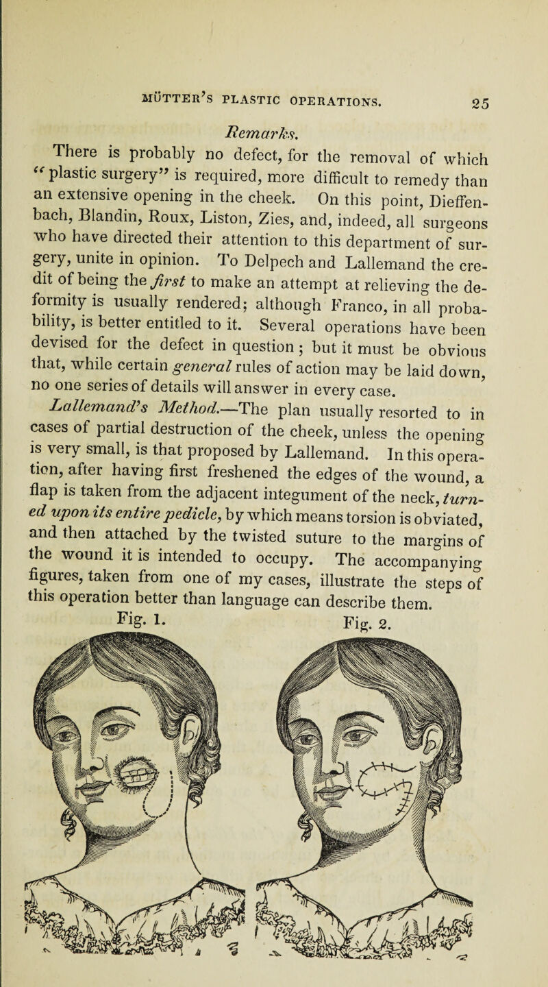 Remarks. There is probably no defect, for the removal of which “ plastic surgery” is required, more difficult to remedy than an extensive opening in the cheek. On this point, Dieffen- bach, Blandin, Roux, Liston, Zies, and, indeed, all surgeons who have diiected their attention to this department of sur¬ gery, unite in opinion. To Delpech and Lallemand the cre¬ dit of being the first to make an attempt at relieving the de¬ formity is usually rendered; although Franco, in all proba¬ bility, is better entitled to it. Several operations have been devised for the defect in question ; but it must be obvious that, while certain general rules of action may be laid down, no one series of details will answer in every case. Lallemand?s Method.—The plan usually resorted to in cases of partial destruction of the cheek, unless the opening is very small, is that proposed by Lallemand. In this opera¬ tion, after having first freshened the edges of the wound, a flap is taken from the adjacent integument of the neck, turn- ed upon its entire pedicle, by which means torsion is obviated, and then attached by the twisted suture to the margins of the wound it is intended to occupy. The accompanying figures, taken from one of my cases, illustrate the steps of this operation better than language can describe them.
