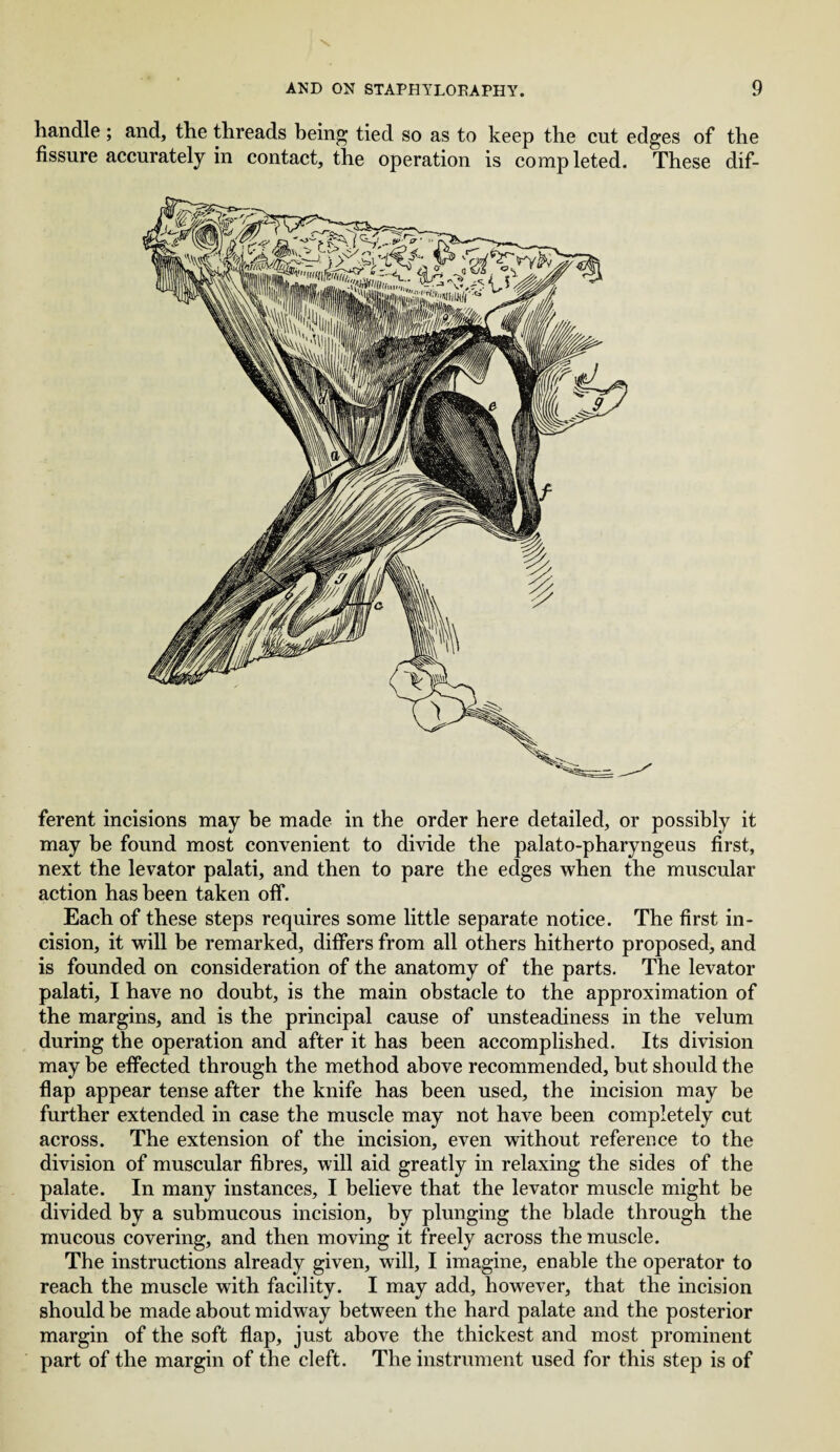 handle ; and, the threads being tied so as to keep the cut edges of the fissure accurately in contact, the operation is completed. These dif¬ ferent incisions may be made in the order here detailed, or possibly it may be found most convenient to divide the palato-pharyngeus first, next the levator palati, and then to pare the edges when the muscular action has been taken off. Each of these steps requires some little separate notice. The first in¬ cision, it will be remarked, differs from all others hitherto proposed, and is founded on consideration of the anatomy of the parts. The levator palati, I have no doubt, is the main obstacle to the approximation of the margins, and is the principal cause of unsteadiness in the velum during the operation and after it has been accomplished. Its division may be effected through the method above recommended, but should the flap appear tense after the knife has been used, the incision may be further extended in case the muscle may not have been completely cut across. The extension of the incision, even without reference to the division of muscular fibres, will aid greatly in relaxing the sides of the palate. In many instances, I believe that the levator muscle might be divided by a submucous incision, by plunging the blade through the mucous covering, and then moving it freely across the muscle. The instructions already given, will, I imagine, enable the operator to reach the muscle with facility. I may add, however, that the incision should be made about midway between the hard palate and the posterior margin of the soft flap, just above the thickest and most prominent part of the margin of the cleft. The instrument used for this step is of