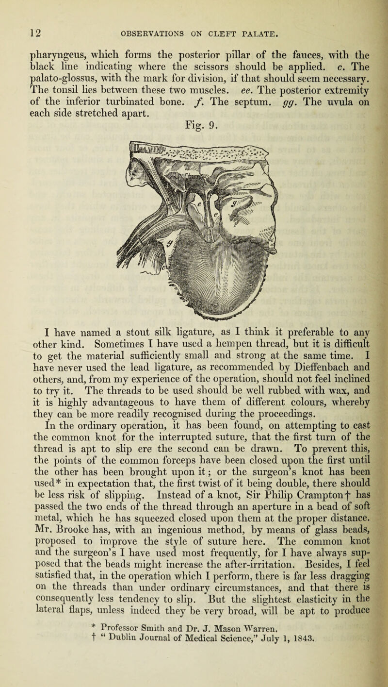 pharyngeus, which forms the posterior pillar of the fauces, with the black line indicating where the scissors should he applied, c. The palato-glossus, with the mark for division, if that should seem necessary. The tonsil lies between these two muscles, ee. The posterior extremity of the inferior turbinated bone. f. The septum, gg. The uvula on each side stretched apart. Fig. 9. I have named a stout silk ligature, as I think it preferable to any other kind. Sometimes I have used a hempen thread, but it is difficult to get the material sufficiently small and strong at the same time. I have never used the lead ligature, as recommended by Dieffenbach and others, and, from my experience of the operation, should not feel inclined to try it. The threads to be used should be well rubbed with wax, and it is highly advantageous to have them of different colours, whereby they can be more readily recognised during the proceedings. In the ordinary operation, it has been found, on attempting to cast the common knot for the interrupted suture, that the first turn of the thread is apt to slip ere the second can be drawn. To prevent this, the points of the common forceps have been closed upon the first until the other has been brought upon it; or the surgeon’s knot has been used* in expectation that, the first twist of it being double, there should be less risk of slipping. Instead of a knot, Sir Philip Cramptonf has passed the two ends of the thread through an aperture in a bead of soft metal, which he has squeezed closed upon them at the proper distance. Mr. Brooke has, with an ingenious method, by means of glass beads, proposed to improve the style of suture here. The common knot and the surgeon’s I have used most frequently, for I have always sup¬ posed that the beads might increase the after-irritation. Besides, I feel satisfied that, in the operation which I perform, there is far less dragging on the threads than under ordinary circumstances, and that there is consequently less tendency to slip. But the slightest elasticity in the lateral flaps, unless indeed they be very broad, will be apt to produce * Professor Smith and Dr. J. Mason Warren.