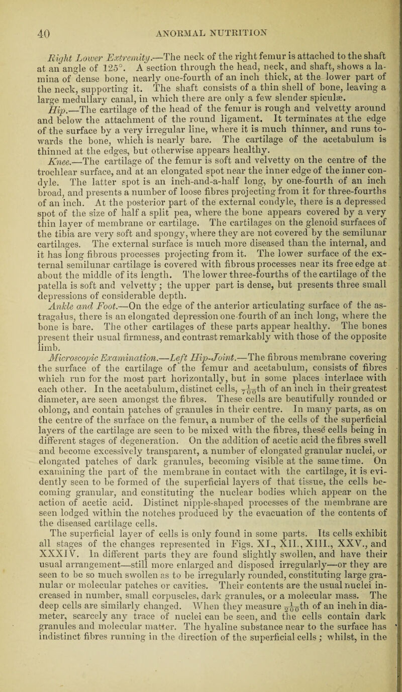 Right Lower Extremity.—The neck of the right femur is attached to the shaft at an angle of 125°. A section through the head, neck, and shaft, shows a la¬ mina of dense bone, nearly one-fourth of an inch thick, at the lower part of the neck, supporting it. The shaft consists of a thin shell of bone, leaving a large medullary canal, in which there are only a few slender spiculse. Hip._The cartilage of the head of the femur is rough and velvetty around and below the attachment of the round ligament. It terminates at the edge of the surface by a very irregular line, where it is much thinner, and runs to¬ wards the bone, which is nearly bare. The cartilage of the acetabulum is thinned at the edges, but otherwise appears healthy. Knee.—The cartilage of the femur is soft and velvetty on the centre of the trochlear surface, and at an elongated spot near the inner edge of the inner con¬ dyle. The latter spot is an inch-and-a-half long, by one-fourth of an inch broad, and presents a number of loose fibres projecting from it for three-fourths of an inch. At the posterior part of the external condyle, there is a depressed spot of the size of half a split pea, where the bone appears covered by a very thin layer of membrane or cartilage. The cartilages on the glenoid surfaces of the tibia are very soft and spongy, where they are not covered by the semilunar cartilages. The* external surface is much more diseased than the internal, and it has long fibrous processes projecting from it. The lower surface of the ex¬ ternal semilunar cartilage is covered with fibrous processes near its free edge at about the middle of its length. The lower three-fourths of the cartilage of the patella is soft and velvetty ; the upper part is dense, but presents three small depressions of considerable depth. Ankle and Foot.—On the edge of the anterior articulating surface of the as¬ tragalus, there is an elongated depression one-fourth of an inch long, where the bone is bare. The other cartilages of these parts appear healthy. The bones present their usual firmness, and contrast remarkably with those of the opposite limb. Microscopic Examination.—Left Hip-Joint.—The fibrous membrane covering the surface of the cartilage of the femur and acetabulum, consists of fibres which run for the most part horizontally, but in some places interlace with each other. In the acetabulum, distinct cells, y^th of an inch in their greatest diameter, are seen amongst the fibres. These cells are beautifully rounded or oblong, and contain patches of granules in their centre. In many parts, as on the centre of the surface on the femur, a number of the cells of the superficial layers of the cartilage are seen to be mixed with the fibres, these cells being in different stages of degeneration. On the addition of acetic acid the fibres swell and become excessively transparent, a number of elongated granular nuclei, or elongated patches of dark granules, becoming visible at the same time. On examining the part of the membrane in contact with the cartilage, it is evi¬ dently seen to be formed of the superficial layers of that tissue, the cells be¬ coming granular, and constituting the nuclear bodies which appear on the action of acetic acid. Distinct nipple-shaped processes of the membrane are seen lodged within the notches produced by the evacuation of the contents of the diseased cartilage cells. The superficial layer of cells is only found in some parts. Its cells exhibit all stages of the changes represented in Figs. XT., XII., XIII., XXV., and XXXIV. In different parts they are found slightly swollen, and have their usual arrangement—still more enlarged and disposed irregularly—or they are seen to be so much swollen as to be irregularly rounded, constituting large gra¬ nular or molecular patches or cavities. Their contents are the usual nuclei in¬ creased in number, small corpuscles, dark granules, or a molecular mass. The deep cells are similarly changed. When they measure ^-^th an inch in dia¬ meter, scarcely any trace of nuclei can be seen, and the cells contain dark granules and molecular matter. The hyaline substance near to the surface has indistinct fibres running in the direction of the superficial cells ; whilst, in the